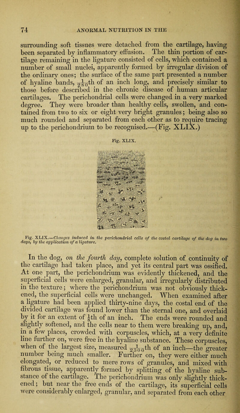 surrounding soft tissues were detached from the cartilage, having been separated by inflammatory effusion. The thin portion of car¬ tilage remaining in the ligature consisted of cells, which contained a number of small nuclei, apparently formed by irregular division of the ordinary ones; the surface of the same part presented a number of hyaline bands, an hich long, and precisely similar to those before described in the chronic disease of human articular cartilages. The perichondrial cells were changed in a very marked degree. They were broader than healthy cells, swollen, and con¬ tained from two to six or eight very bright granules; being also so much rounded and separated from each other as to require tracing up to the perichondrium to be recognised.—(Fig. XLIX.) Fig. XLIX. Fig. XLIX.—Changes induced in the perichondrial cells of the costal cartilage of the dog in two days, by the application of a ligature. In the dog, on the fourth day, complete solution of continuity of the cartilage had taken place, and yet its central part was ossified. At one part, the perichondrium was evidently thickened, and the superficial cells were enlarged, granular, and irregularly distributed in the texture; where the perichondrium was not obviously thick¬ ened, the superficial cells were unchanged. When examined after a ligature had been applied thirty-nine days, the costal end of the divided cartilage was found lower than the sternal one, and overlaid by it for an extent of Jth of an inch. The ends were rounded and slightly softened, and the cells near to them were breaking up, and, in a few places, crowded with corpuscles, which, at a very definite line further on, were free in the hyaline substance. These corpuscles, when of the largest size, measured gg^th °f an inch—the greater number being much smaller. Further on, they were either much elongated, or reduced to mere rows of granules, and mixed with fibrous tissue, apparently formed by splitting of the hyaline sub¬ stance of the cartilage. The perichondrium was only slightly thick¬ ened ; but near the free ends of the cartilage, its superficial cells were considerably enlarged, granular, and separated from each other