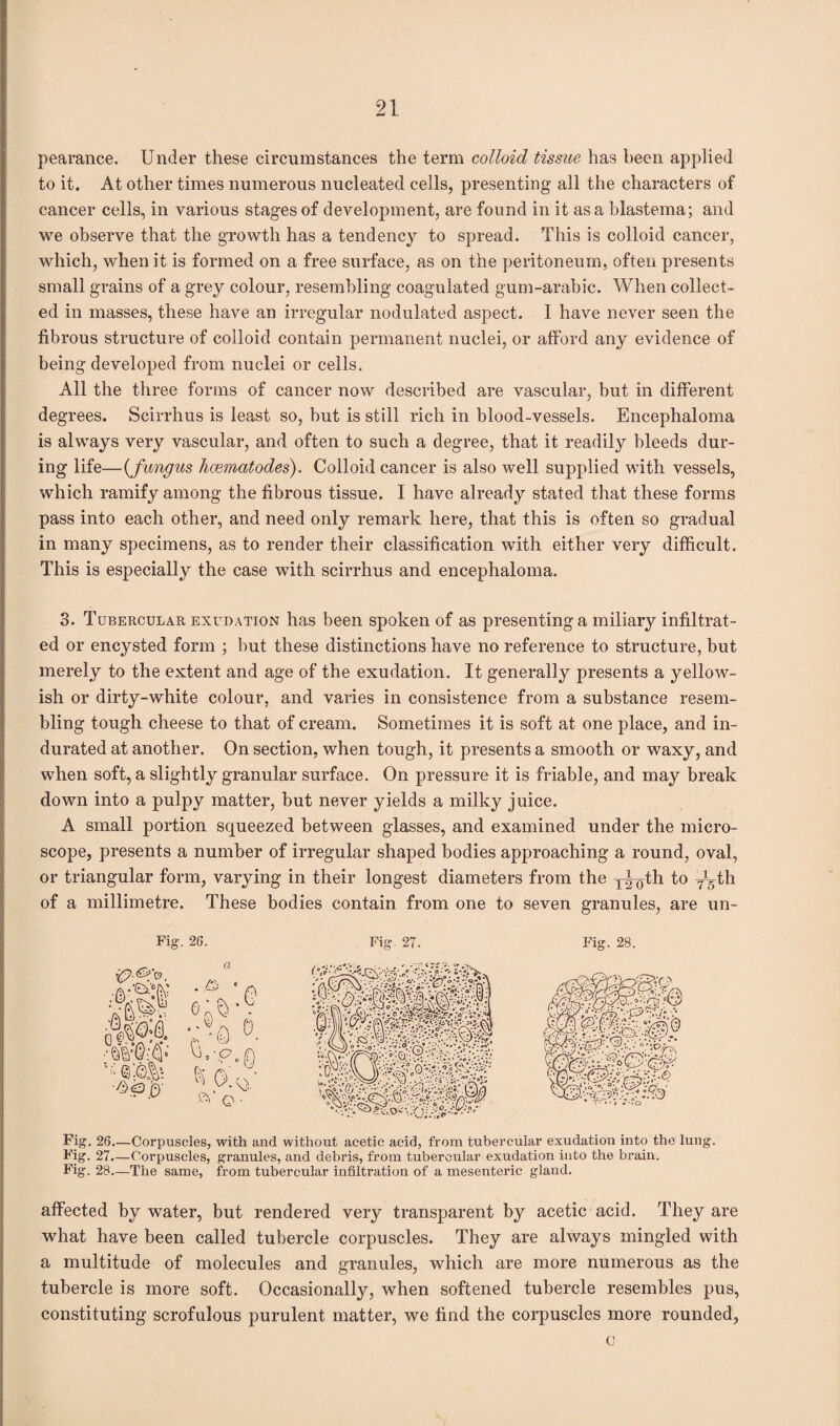 pearance. Under these circumstances the term colloid tissue has been applied to it. At other times numerous nucleated cells, presenting all the characters of cancer cells, in various stages of development, are found in it as a blastema; and we observe that the growth has a tendency to spread. This is colloid cancer, which, when it is formed on a free surface, as on the peritoneum, often presents small grains of a grey colour, resembling coagulated gum-arabic. When collect¬ ed in masses, these have an irregular nodulated aspect. I have never seen the fibrous structure of colloid contain permanent nuclei, or afford any evidence of being developed from nuclei or cells. All the three forms of cancer now described are vascular, but in different degrees. Scirrhus is least so, but is still rich in blood-vessels. Encephaloma is always very vascular, and often to such a degree, that it readily bleeds dur¬ ing life—(fungus hcematodes). Colloid cancer is also well supplied with vessels, which ramify among the fibrous tissue. I have already stated that these forms pass into each other, and need only remark here, that this is often so gradual in many specimens, as to render their classification with either very difficult. This is especially the case with scirrhus and encephaloma. 3. Tubercular exudation has been spoken of as presenting a miliary infiltrat¬ ed or encysted form ; but these distinctions have no reference to structure, but merely to the extent and age of the exudation. It generally presents a yellow¬ ish or dirty-white colour, and varies in consistence from a substance resem¬ bling tough cheese to that of cream. Sometimes it is soft at one place, and in¬ durated at another. On section, when tough, it presents a smooth or waxy, and when soft, a slightly granular surface. On pressure it is friable, and may break down into a pulpy matter, but never yields a milky juice. A small portion squeezed between glasses, and examined under the micro¬ scope, presents a number of irregular shaped bodies approaching a round, oval, or triangular form, varying in their longest diameters from the y^th to y^th of a millimetre. These bodies contain from one to seven granules, are un- Fig. 26. Fig. 27. a ■ ’ A wmmm OfH ft -a • aft? v; ■yj>p0- % o:S w o • SSiS’ .. Fig. 28. Fig. 26.—Corpuscles, with and without acetic acid, from tubercular exudation into the lung. Fig. 27.—Corpuscles, granules, and debris, from tubercular exudation into the brain. Fig. 28—The same, from tubercular infiltration of a mesenteric gland. affected by water, but rendered very transparent by acetic acid. They are what have been called tubercle corpuscles. They are always mingled with a multitude of molecules and granules, which are more numerous as the tubercle is more soft. Occasionally, when softened tubercle resembles pus, constituting scrofulous purulent matter, we find the corpuscles more rounded, c