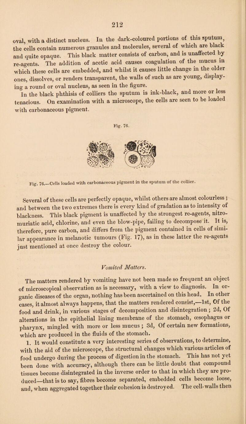 oval, with a distinct nucleus. In the dark-coloured portions of this sputum, the cells contain numerous granules and molecules, several of which are black and quite opaque. This black matter consists of carbon, and is unaffected by re-agents. The addition of acetic acid causes coagulation of the mucus in which these cells are embedded, and whilst it causes little change in the older ones, dissolves, or renders transparent, the walls of such as are young, display¬ ing a round or oval nucleus, as seen in the figure. In the black phthisis of colliers the sputum is ink-black, and more or less tenacious. On examination with a microscope, the cells are seen to be loaded with carbonaceous pigment. Fig. 76. Fig. 76_Cells loaded with carbonaceous pigment in the sputum of the collier. Several of these cells are perfectly opaque, whilst others are almost colourless ; and between the two extremes there is every kind of gradation as to intensity of blackness. This black pigment is unaffected by the strongest re-agents, nitro- muriatic acid, chlorine, and even the blow-pipe, failing to decompose it. It is, therefore, pure carbon, and differs from the pigment contained in cells of simi¬ lar appearance in melanotic tumours (Fig. 17), as in these latter the re-agents just mentioned at once destroy the colour. Vomited Matters. The matters rendered by vomiting have not been made so frequent an object of microscopical observation as is necessary, with a view to diagnosis. In oi- ganic diseases of the organ, nothing has been ascertained on this head. In other cases, it almost always happens, that the matters rendered consist,—1st, Of the food and drink, in various stages of decomposition and disintegration ; 2d, Of alterations in the epithelial lining membrane of the stomach, oesophagus or pharynx, mingled with more or less mucus ; 3d, Of certain new formations, which are produced in the fluids of the stomach. 1 Jt would constitute a very interesting series of observations, to determine, with the aid of the microscope, the structural changes which various articles of food undergo during the process of digestion in the stomach. This has not yet been done with accuracy, although there can be little doubt that compound tissues become disintegrated in the inverse order to that in which they are pro¬ duced_that is to say, fibres become separated, embedded cells become loose, and, when aggregated together their cohesion is destroyed. The cell-walls then