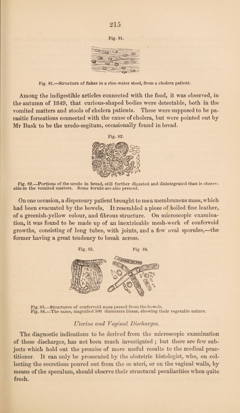 Fig. 81. iSagsg =<33^ :ca..~ Fig. 81.—Structure of flakes in a rice-water stool, from a cholera patient. Among the indigestible articles connected with the food, it was observed, in the autumn of 1849, that curious-shaped bodies were detectable, both in the vomited matters and stools of cholera patients. These were supposed to be pa¬ rasitic formations connected with the cause of cholera, but were pointed out by Mr Busk to be the uredo-segitum, occasionally found in bread. Fig. 82- Fig. 82.—Portions of the uredo in bread, still further digested and disintegrated than is observ¬ able in the vomited matters. Some ferulas are also present. On one occasion, a dispensary patient brought to me a membranous mass, which had been evacuated by the bowels. It resembled a piece of boiled fine leather, of a greenish-yellow colour, and fibrous structure. On microscopic examina¬ tion, it was found to be made up of an inextricable mesh-work of confervoid growths, consisting of long tubes, with joints, and a few oval sporules,—the former having a great tendency to break across. Fig. 83. Fig 84. Fig. 83.—Structures of confervoid mass passed from the bowels. Fig. 84_The same, magnified 500 diameters linear, showing their vegetable nature. Uterine and Vaginal Discharges. The diagnostic indications to be derived from the microscopic examination of these discharges, has not been much investigated ; but there are few sub¬ jects which hold out the promise of more useful results to the medical prac¬ titioner. It can only be prosecuted by the obstetric histologist, who, on col¬ lecting the secretions poured out from the os uteri, or on the vaginal walls, by means of the speculum, should observe their structural peculiarities when quite fresh.