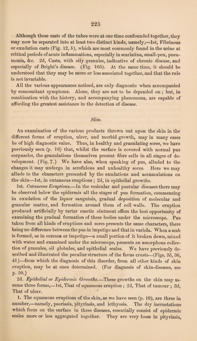 Although these casts of the tubes were at one time confounded together, they may now be separated into at least two distinct kinds, namely,—1st, Fibrinous or exudation casts (Fig. 12, b), which are most commonly found in the urine at critical periods of acute inflammations, especially in scarlatina, small-pox, pneu¬ monia, &c. 2d, Casts, with oily granules, indicative of chronic disease, and especially of Bright’s disease. (Fig. 103). At the same time, it should be understood that they may be more or less associated together, and that the rule is not invariable. All the various appearances noticed, are only diagnostic when accompanied by concomitant symptoms. Alone, they are not to be depended on ; but, in combination with the history, and accompanying phenomena, are capable of affording the greatest assistance in the detection of disease. Shin. An examination of the various products thrown out upon the skin in the different forms of eruption, ulcer, and morbid growth, may in many cases be of high diagnostic value. Thus, in healthy and granulating sores, we have previously seen (p. 16) that, whilst the surface is covered with normal pus corpuscles, the granulations themselves present fibre cells in all stages of de¬ velopment. (Fig. 7.) We have also, when speaking of pus, alluded to the changes it may undergo in scrofulous and unhealthy sores. Here we may allude to the characters presented by the exudations and accumulations on the skin—1st, in cutaneous eruptions ; 2d, in epithelial growths. 1st. Cutaneous Eruptions.—In the vesicular and pustular diseases there may be observed below the epidermis all the stages of pus formation, commencing in exudation of the liquor sanguinis, gradual deposition of molecular and granular matter, and formation around them of cell walls. The eruption produced artificially by tartar emetic ointment offers the best opportunity of examining the gradual formation of these bodies under the microscope. Pus taken from all kinds of eruptions and sores presents the same characters, there being no difference between the pus in impetigo and that in variola. When a scab is formed, as in eczema or impetigo—a small portion of it broken down, mixed with water and examined under the microscope, presents an amorphous collec¬ tion of granules, oil globules, and epithelial scales. We have previously de¬ scribed and illustrated the peculiar structure of the favus crusts—(Figs. 35, 36, 41)—from which the diagnosis of this disorder, from all other kinds of skin eruption, may be at once determined. (For diagnosis of skin-diseases, see p. 50.) 2d. Epithelial or Epidermic Growths.—These growths on the skin may as¬ sume three forms,—1st, That of squamous eruption ; 2d, That of tumour ; 3d, That of ulcer. 1. The squamous eruptions of the skin, as we have seen (p. 19), are three in number,—namely, psoriasis, pityriasis, and icthyosis. The dry incrustations which form on the surface in these diseases, essentially consist of epidermic scales more or less aggregated together. They are very loose in pityriasis.