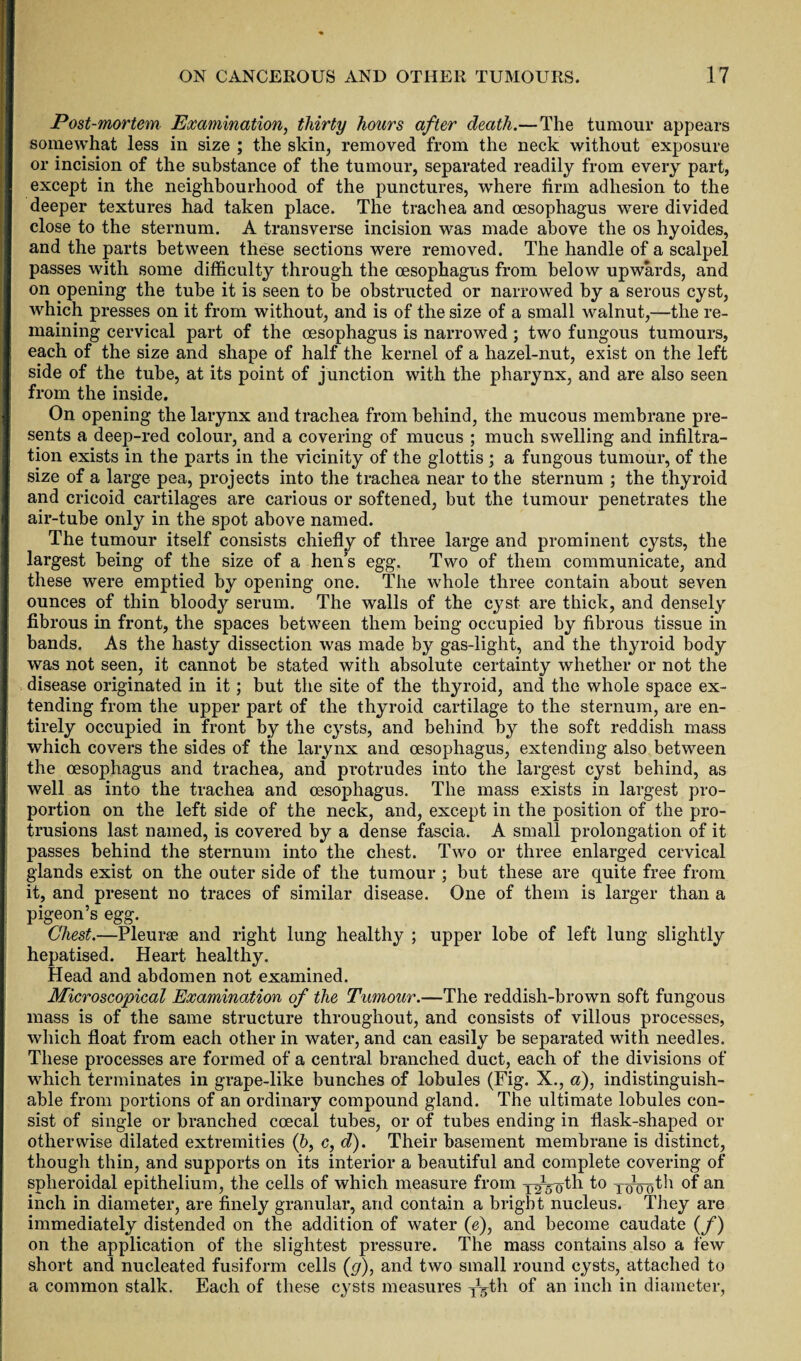 Post-mortem Examination, thirty hours after death.—The tumour appears somewhat less in size ; the skin, removed from the neck without exposure or incision of the substance of the tumour, separated readily from every part, except in the neighbourhood of the punctures, where tirm adhesion to the deeper textures had taken place. The trachea and oesophagus were divided close to the sternum. A transverse incision was made above the os hyoides, and the parts between these sections were removed. The handle of a scalpel passes with some difficulty through the oesophagus from below upwards, and on opening the tube it is seen to be obstructed or narrowed by a serous cyst, which presses on it from without, and is of the size of a small walnut,—the re¬ maining cervical part of the oesophagus is narrowed ; two fungous tumours, each, of the size and shape of half the kernel of a hazel-nut, exist on the left side of the tube, at its point of junction with the pharynx, and are also seen from the inside. On opening the larynx and trachea from behind, the mucous membrane pre¬ sents a deep-red colour, and a covering of mucus ; much swelling and infiltra¬ tion exists in the parts in the vicinity of the glottis ; a fungous tumour, of the size of a large pea, projects into the trachea near to the sternum ; the thyroid and cricoid cartilages are carious or softened, but the tumour penetrates the air-tube only in the spot above named. The tumour itself consists chiefly of three large and prominent cysts, the largest being of the size of a hen’s egg. Two of them communicate, and these were emptied by opening one. The whole three contain about seven ounces of thin bloody serum. The walls of the cyst are thick, and densely fibrous in front, the spaces between them being occupied by fibrous tissue in bands. As the hasty dissection was made by gas-light, and the thyroid body was not seen, it cannot be stated with absolute certainty whether or not the disease originated in it; but the site of the thyroid, and the whole space ex¬ tending from the upper part of the thyroid cartilage to the sternum, are en¬ tirely occupied in front by the cysts, and behind by the soft reddish mass which covers the sides of the larynx and oesophagus, extending also between the oesophagus and trachea, and protrudes into the largest cyst behind, as well as into the trachea and oesophagus. The mass exists in largest pro¬ portion on the left side of the neck, and, except in the position of the pro¬ trusions last named, is covered by a dense fascia. A small prolongation of it passes behind the sternum into the chest. Two or three enlarged cervical glands exist on the outer side of the tumour ; but these are quite free from it, and present no traces of similar disease. One of them is larger than a pigeon’s egg. Chest.—Pleurae and right lung healthy ; upper lobe of left lung slightly hepatised. Heart healthy. Head and abdomen not examined. Microscopical Examination of the Tumour.—The reddish-brown soft fungous mass is of the same structure throughout, and consists of villous processes, which float from each other in water, and can easily be separated with needles. These processes are formed of a central branched duct, each of the divisions of which terminates in grape-like bunches of lobules (Fig. X., a), indistinguish¬ able from portions of an ordinary compound gland. The ultimate lobules con¬ sist of single or branched coecal tubes, or of tubes ending in flask-shaped or otherwise dilated extremities (6, c, d). Their basement membrane is distinct, though thin, and supports on its interior a beautiful and complete covering of spheroidal epithelium, the cells of which measure from y^^th to 101(JDtii of an inch in diameter, are finely granular, and contain a bright nucleus. They are immediately distended on the addition of water (e), and become caudate (f) on the application of the slightest pressure. The mass contains also a few short and nucleated fusiform cells (g), and two small round cysts, attached to a common stalk. Each of these cysts measures T^th of an inch in diameter,