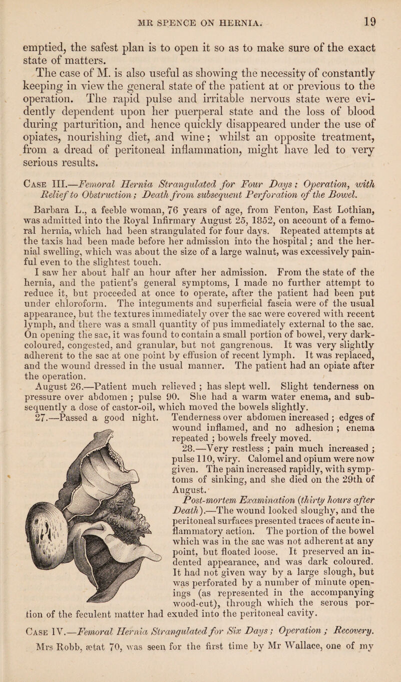 emptied, the safest plan is to open it so as to make sure of the exact state of matters. The case of M. is also useful as showing the necessity of constantly keeping in view the general state of the patient at or previous to the operation. The rapid pulse and irritable nervous state were evi¬ dently dependent upon her puerperal state and the loss of blood during parturition, and hence quickly disappeared under the use of opiates, nourishing diet, and wine; whilst an opposite treatment, from a dread of peritoneal inflammation, might have led to very serious results. Case III.—Femoral Hernia Strangulated for Four Days; Operation, with Relief to Obstruction; Death from subsequent Perforation of the Bowel. Barbara L., a feeble woman, 76 years of age, from Fenton, East Lothian, was admitted into the Royal Infirmary August 25, 1852, on account of a femo¬ ral hernia, which had been strangulated for four days. Repeated attempts at the taxis had been made before her admission into the hospital; and the her¬ nial swelling, which was about the size of a large walnut, was excessively pain¬ ful even to the slightest touch. I saw her about half an hour after her admission. From the state of the hernia, and the patient’s general symptoms, I made no further attempt to reduce it, but proceeded at once to operate, after the patient had been put under chloroform. The integuments and superficial fascia were of the usual appearance, but the textures immediately over the sac were covered with recent lymph, and there was a small quantity of pus immediately external to the sac. On opening the sac, it was found to contain a small portion of bowel, very dark- coloured, congested, and granular, but not gangrenous. It was very slightly adherent to the sac at one point by effusion of recent lymph. It was replaced, and the wound dressed in the usual manner. The patient had an opiate after the operation. August 26.—Patient much relieved ; has slept well. Slight tenderness on pressure over abdomen ; pulse 90. She had a warm water enema, and sub¬ sequently a dose of castor-oil, which moved the bowels slightly. Tenderness over abdomen increased ; edges of wound inflamed, and no adhesion ; enema repeated ; bowels freely moved. 28.—Very restless ; pain much increased ; pulse 110, wiry. Calomel and opium were now given. The pain increased rapidly, with symp¬ toms of sinking, and she died on the 29th of August. Post-mortem Examination (thirty hours after Death).—The wound looked sloughy, and the peritoneal surfaces presented traces of acute in¬ flammatory action. The portion of the bowel which was in the sac was not adherent at any point, but floated loose. It preserved an in¬ dented appearance, and was dark coloured. It had not given way by a large slough, but was perforated by a number of minute open¬ ings (as represented in the accompanying wood-cut), through which the serous por¬ tion of the feculent matter had exuded into the peritoneal cavity. Case IV.—Femoral Hernia Strangulated for Six Days; Operation ; Recovery. Mrs Robb, eetat 70, was seen for the first time by Mr Wallace, one of my
