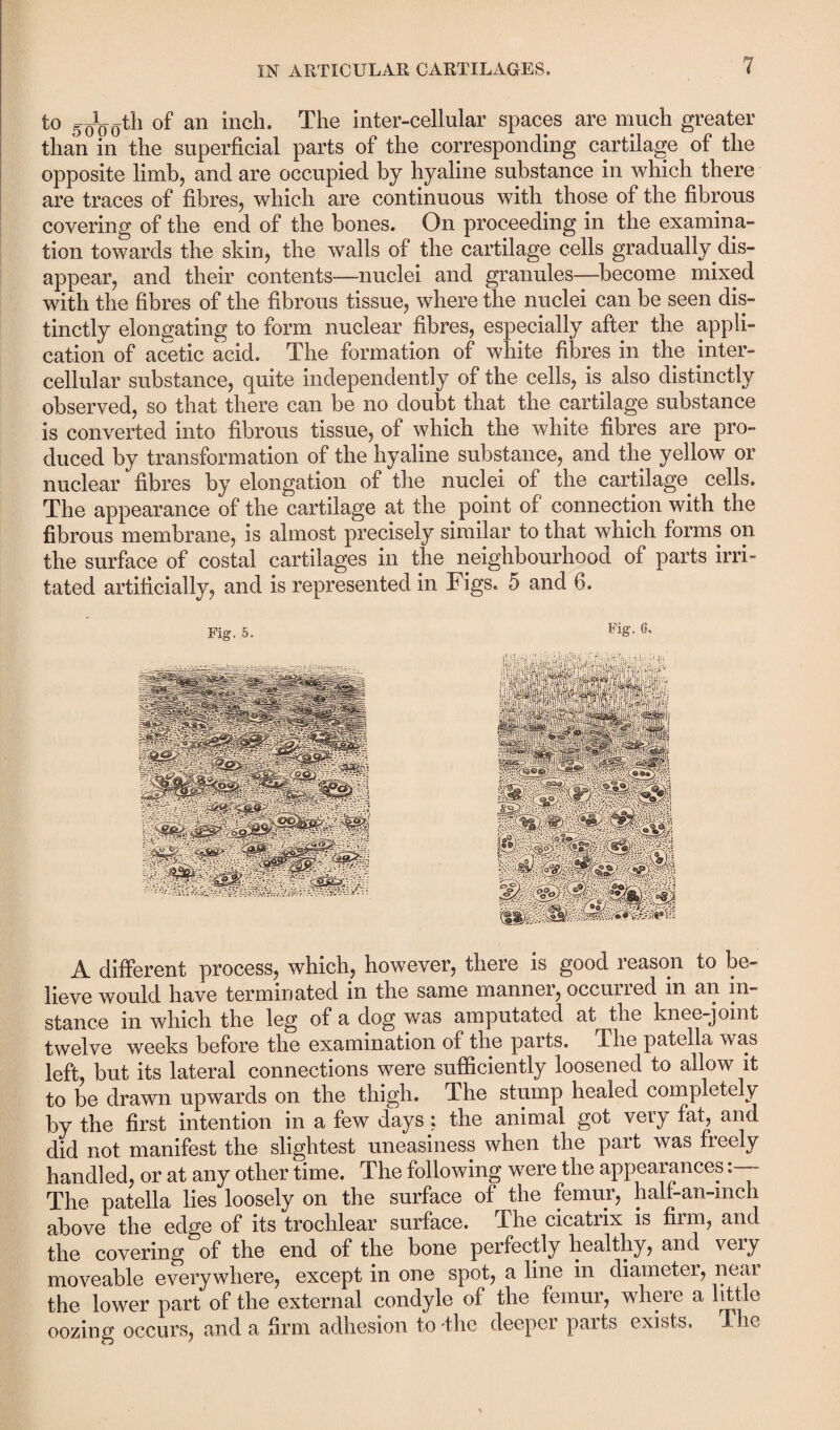 to of an inch. The inter-cellular spaces are much greater than in the superficial parts of the corresponding cartilage of the opposite limb, and are occupied by hyaline substance in which there are traces of fibres, which are continuous with those of the fibrous covering of the end of the bones. On proceeding in the examina¬ tion towards the skin, the walls of the cartilage cells gradually dis¬ appear, and their contents—nuclei and granules—become mixed with the fibres of the fibrous tissue, where the nuclei can be seen dis¬ tinctly elongating to form nuclear fibres, especially after the appli¬ cation of acetic acid. The formation of white fibres in the inter¬ cellular substance, quite independently of the cells, is also distinctly observed, so that there can be no doubt that the cartilage substance is converted into fibrous tissue, of which the white fibres are pro¬ duced by transformation of the hyaline substance, and the yellow or nuclear fibres by elongation of the nuclei of the cartilage cells. The appearance of the cartilage at the point of connection with the fibrous membrane, is almost precisely similar to that which forms on the surface of costal cartilages in the neighbourhood of parts irri¬ tated artificially, and is represented in Figs. 5 and 6. Fig. 5. FiX A different process, which, however, there is good reason to be¬ lieve would have terminated in the same manner, occurred in an in¬ stance in which the leg of a dog was amputated at the knee-joint twelve weeks before the examination of the parts. The patella was left, but its lateral connections were sufficiently loosened to allow it to be drawn upwards on the thigh. The stump healed completely by the first intention in a few days: the animal got very fat, and did not manifest the slightest uneasiness when the part was freely handled, or at any other time. The following were the appearances- The patella lies loosely on the surface of the femur, half-an-mch above the edge of its trochlear surface. The cicatrix is firm, and the covering of the end of the bone perfectly healthy, and \eiy moveable everywhere, except in one spot, a line in diameter, near the lower part of the external condyle of the femur, where a little oozing occurs, and a firm adhesion to'the deeper parts exists. The