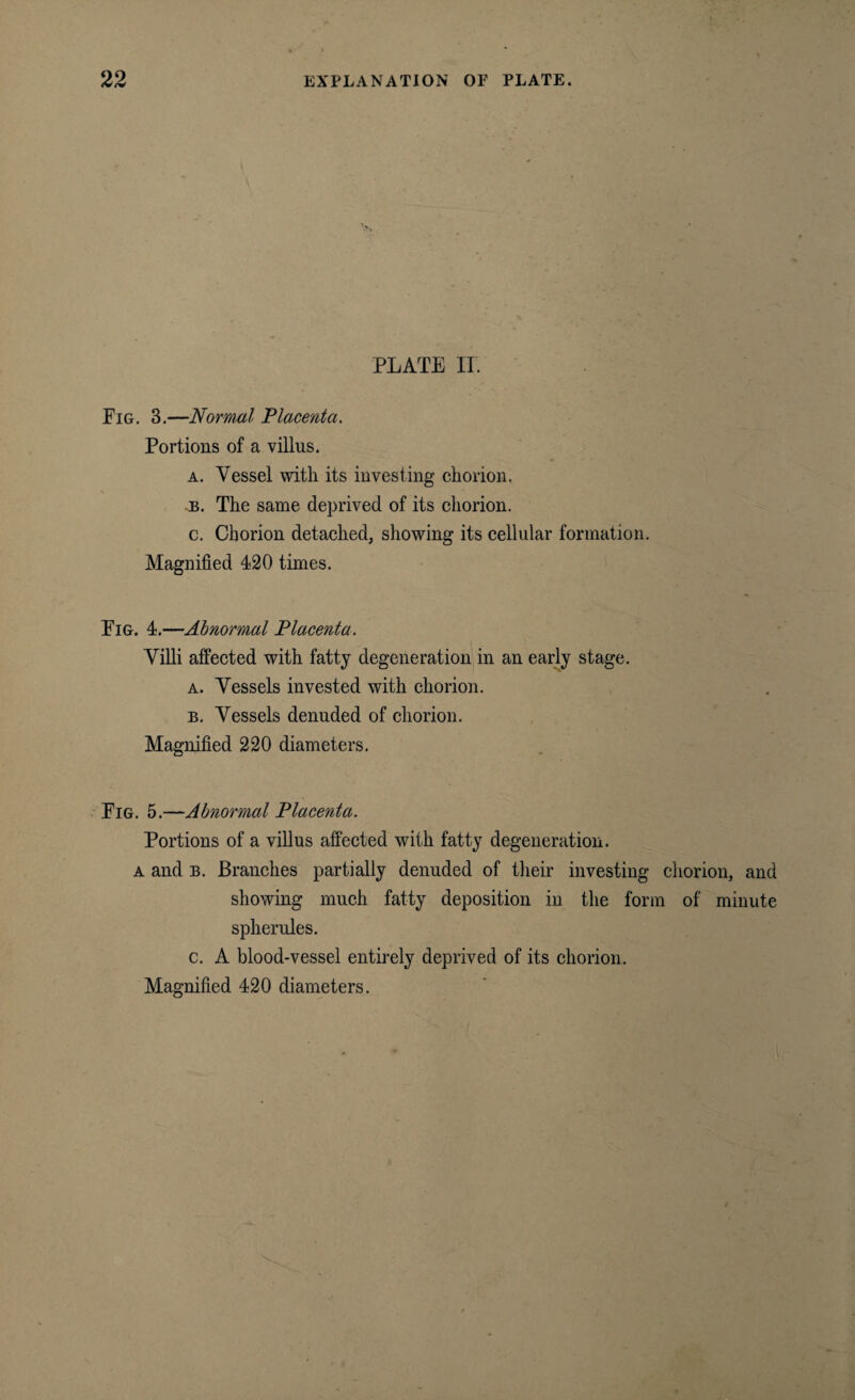 PLATE II. Fig. 3.—Normal Placenta. Portions of a villus. a. Vessel with its investing chorion. b. The same deprived of its chorion. c. Chorion detached, showing its cellular formation. Magnified 420 times. Fig. 4.—Abnormal Placenta. Villi affected with fatty degeneration in an early stage. a. Vessels invested with chorion. b. Vessels denuded of chorion. Magnified 220 diameters. Fig. 5.—Abnormal Placenta. Portions of a villus affected with fatty degeneration. a and b. Branches partially denuded of them investing chorion, and showing much fatty deposition in the form of minute spherules. c. A blood-vessel entirely deprived of its chorion. Magnified 420 diameters.