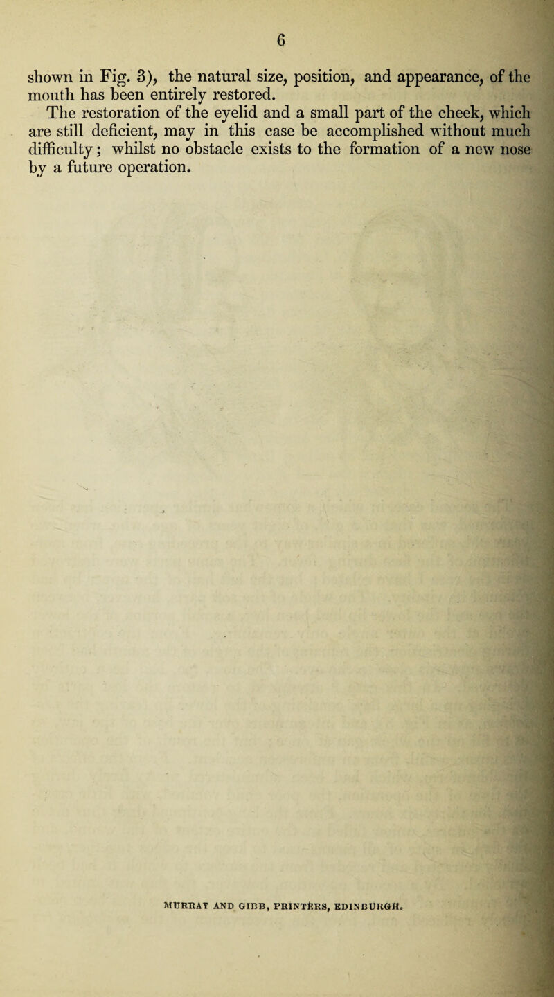 shown in Fig. 3), the natural size, position, and appearance, of the mouth has been entirely restored. The restoration of the eyelid and a small part of the cheek, which are still deficient, may in this case be accomplished without much difficulty; whilst no obstacle exists to the formation of a new nose by a future operation. MURRAY AND GIBB, PRINTERS, EDINBURGH.