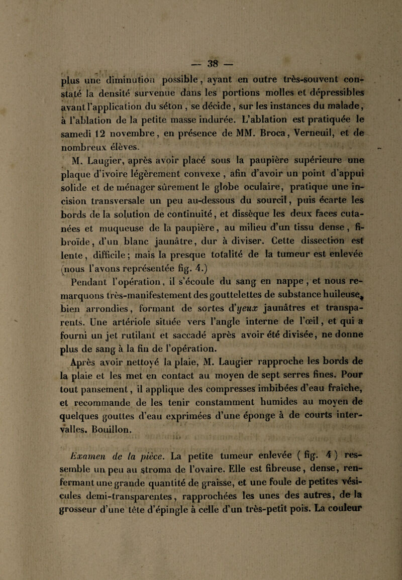 t ^ r plus une diminution possible, ayant en outre très-souvent con¬ staté la densité survenue dans les portions molles et dépressibles avant l’application du séton , se décide, sur les instances du malade, à l’ablation de la petite masse indurée. L’ablation est pratiquée le samedi 12 novembre, en présence de MM. Broca, Verneuil, et de nombreux élèves. M. Laugier, après avoir placé sous la paupière supérieure une plaque d’ivoire légèrement convexe , afin d’avoir un point d’appui solide et de ménager sûrement le globe oculaire, pratique une in¬ cision transversale un peu au-dessous du sourcil, puis écarte les bords de la solution de continuité, et dissèque les deux faces cuta¬ nées et muqueuse de la paupière, au milieu d’un tissu dense , fi- broïde, d’un blanc jaunâtre, dur à diviser. Cette dissection est lente, difficile ; mais la presque totalité de la tumeur est enlevée (nous l’avons représentée fig. 4.) Pendant l’opération, il s’écoule du sang en nappe , et nous re¬ marquons très-manifestement des gouttelettes de substance huileuse^ bien arrondies, formant de sortes d'yeux jaunâtres et transpa¬ rents. Une artériole située vers l’angle interne de l’œil, et qui a fourni un jet rutilant et saccadé après avoir été divisée, ne donne plus de sang à la fin de l’opération. Après avoir nettoyé la plaie, M. Laugier rapproche les bords de la plaie et les met en contact au moyen de sept serres fines. Pour tout pansement, il applique des compresses imbibées d’eau fraîche, et recommande de les tenir constamment humides au moyen de quelques gouttes d’eau exprimées d’une éponge à de courts inter¬ valles. Bouillon. Examen de la pièce. La petite tumeur enlevée ( fig. 4 ) res¬ semble un peu au stroma de l’ovaire. Elle est fibreuse, dense, ren¬ fermant une grande quantité de graisse, et une foule de petites vési¬ cules demi-transparentes, rapprochées les unes des autres, delà grosseur d’une tête d’épingle à celle d’un très-petit pois. La couleur