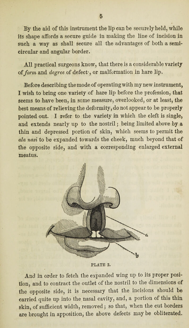 By the aid of this instrument the lip can be securely held, while its shape affords a secure guide in making the line of incision in such a way as shall secure all the advantages of both a semi¬ circular and angular border. All practical surgeons know, that there is a considerable variety of form and degree of defect*, or malformation in hare lip. Before describing the mode of operating with my new instrument, I wish to bring one variety of hare lip before the profession, that seems to have been, in some measure, overlooked, or at least, the best means of relieving the deformity, do not appear to be properly pointed out. I refer to the variety in which the cleft is single, and extends nearly up to the nostril; being limited above by a thin and depressed portion of skin, which seems to permit the ala nasi to be expanded towards the cheek, much beyond that of the opposite side, and with a corresponding enlarged external meatus. a PLATE 2 And in order to fetch the expanded wing up to its proper posi¬ tion, and to contract the outlet of the nostril to the dimensions of the opposite side, it is necessary that the incisions should be carried quite up into the nasal cavity, and, a portion of this thin skin, of sufficient width, removed; so that, when the cut borders are brought in apposition, the above defects may be obliterated.
