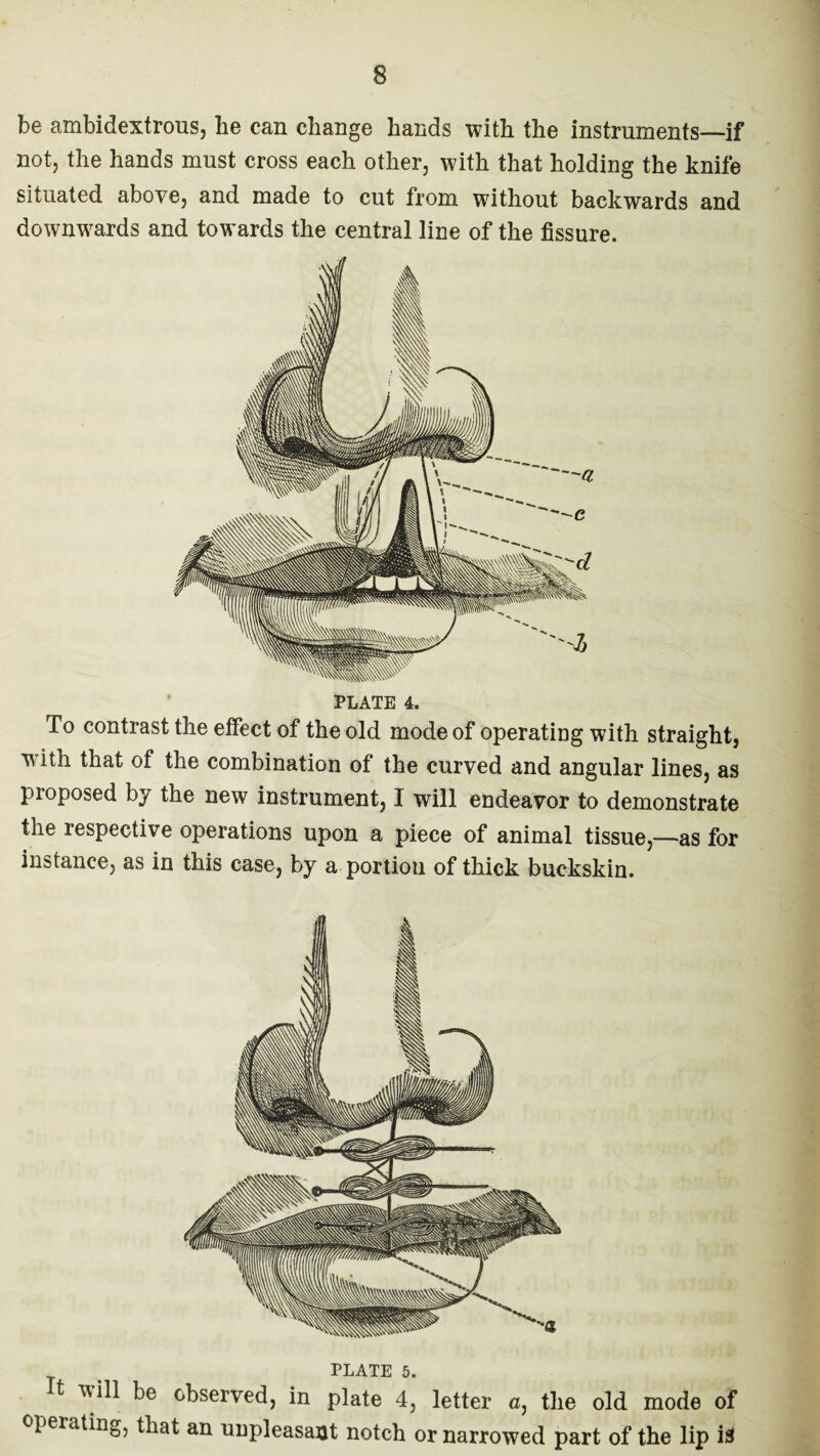 s be ambidextrous, he can change hands with the instruments—if not, the hands must cross each other, with that holding the knife situated above, and made to cut from without backwards and downwards and towards the central line of the fissure. PLATE 4. To contrast the effect of the old mode of operating with straight, with that of the combination of the curved and angular lines, as proposed by the new instrument, I will endeavor to demonstrate the respective operations upon a piece of animal tissue,—as for instance, as in this case, by a portion of thick buckskin. PLATE 5. t will be observed, in plate 4, letter a, the old mode of operating, that an unpleasant notch or narrowed part of the lip i3