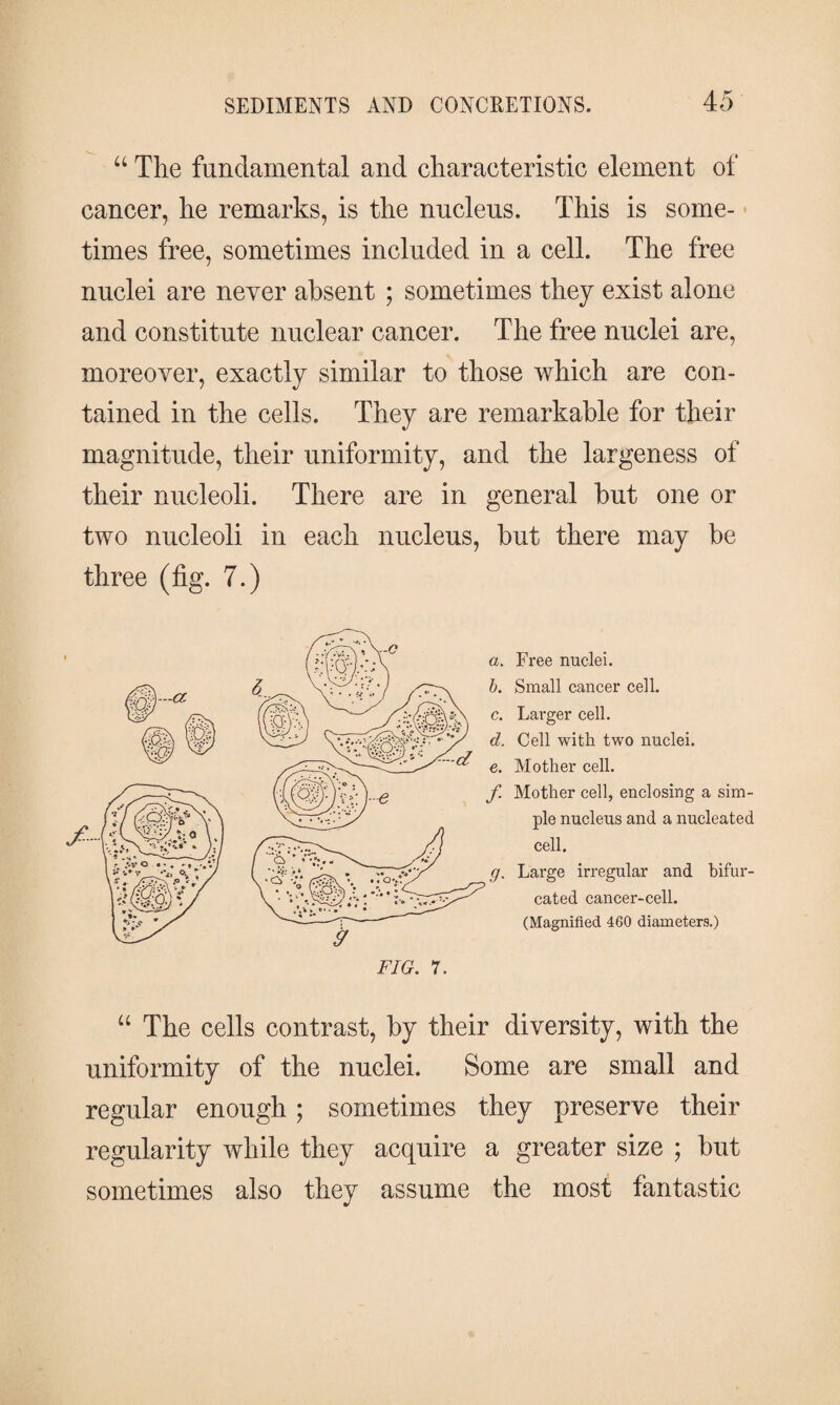 a The fundamental and characteristic element of cancer, he remarks, is the nucleus. This is some¬ times free, sometimes included in a cell. The free nuclei are never absent ; sometimes they exist alone and constitute nuclear cancer. The free nuclei are, moreover, exactly similar to those which are con¬ tained in the cells. They are remarkable for their magnitude, their uniformity, and the largeness of their nucleoli. There are in general but one or two nucleoli in each nucleus, but there may be three (fig. 7.) a. Free nuclei. b. Small cancer cell. c. Larger cell. d. Cell with two nuclei. e. Mother cell. f Mother cell, enclosing a sim¬ ple nucleus and a nucleated cell. g. Large irregular and bifur¬ cated cancer-cell. (Magnified 460 diameters.) “ The cells contrast, by their diversity, with the uniformity of the nuclei. Some are small and regular enough; sometimes they preserve their regularity while they acquire a greater size ; but sometimes also they assume the most fantastic