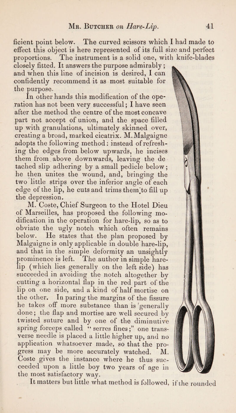 ficient point below. The curved scissors which I had made to effect this object is here represented of its full size and perfect proportions. The instrument is a solid one, with knife-blades closely fitted. It answers the purpose admirably; and when this line of incision is desired, I can confidently recommend it as most suitable for the purpose. In other hands this modification of the ope¬ ration has not been very successful; I have seen after the method the centre of the most concave part not accept of union, and the space filled up with granulations, ultimately skinned over, creating a broad, marked cicatrix. M.Malgaigne adopts the following method: instead of refresh¬ ing the edges from below upwards, he incises them from above downwards, leaving the de tached slip adhering by a small pedicle below; he then unites the wound, and, bringing the two little strips over the inferior angle of each edge of the lip, he cuts and trims thenkto fill up the depression. M. Coste, Chief Surgeon to the Hotel Dieu of Marseilles, has proposed the following mo¬ dification in the operation for hare-lip, so as to obviate the ugly notch which often remains below. He states that the plan proposed by Malgaigne is only applicable in double hare-lip, and that in the simple deformity an unsightly prominence is left. The author in simple hare¬ lip (which lies generally on the left side) has succeeded in avoiding the notch altogether by cutting a horizontal flap in the red part of the lip on one side, and a kind of half mortise on the other. In paring the margins of the fissure he takes off more substance than is 'generally done; the flap and mortise are well secured by twisted suture and by one of the diminutive spring forceps called “ serres fines;” one trans¬ verse needle is placed a little higher up, and no application whatsoever made, so that the pro¬ gress may be more accurately watched. M. Coste gives the instance where he thus suc¬ ceeded upon a little boy two years of age in the most satisfactory way. It matters but little what method is followed, if the roun ded