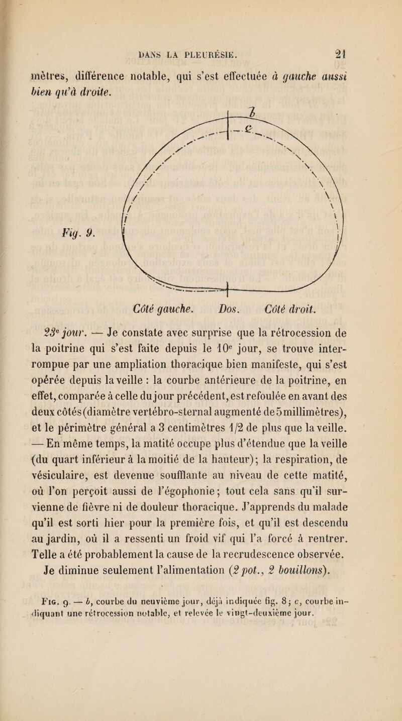 mètres, différence notable, qui s’est effectuée à gauche aussi bien qu’à droite. 23e jour. — Je constate avec surprise que la rétrocession de la poitrine qui s’est Faite depuis le 10e jour, se trouve inter¬ rompue par une ampliation thoracique bien manifeste, qui s’est opérée depuis la veille : la courbe antérieure de la poitrine, en effet, comparée à celle du jour précédent, est refoulée en avant des deux côtés (diamètre vertébro-sternal augmenté de 5 millimètres), et le périmètre général a 3 centimètres 1/2 de plus que la veille. — En même temps, la matité occupe plus d’étendue que la veille (du quart inférieur à la moitié de la hauteur); la respiration, de vésiculaire, est devenue soufflante au niveau de cette matité, où l’on perçoit aussi de l’égophonie ; tout cela sans qu’il sur¬ vienne de fièvre ni de douleur thoracique. J’apprends du malade qu’il est sorti hier pour la première fois, et qu’il est descendu au jardin, où il a ressenti un froid vif qui l’a forcé à rentrer. Telle a été probablement la cause de la recrudescence observée. Je diminue seulement l’alimentation (2pot., 2 bouillons). Fig. 9. — b, courbe du neuvième jour, déjà indiquée fig. 8; c, courbe in¬ diquant une rétrocession notable, et relevée le vingt-deuxième jour.