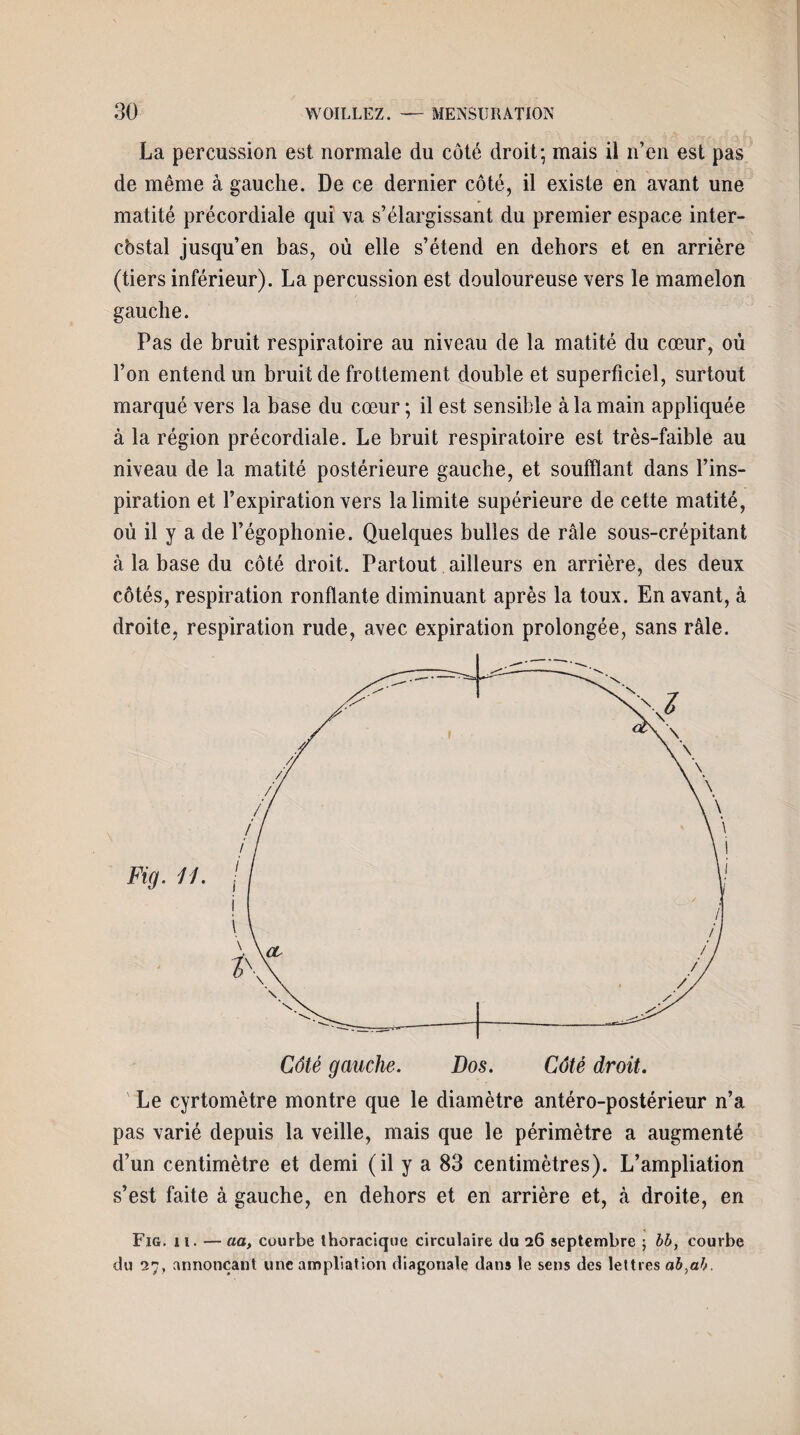 La percussion est normale du côté droit; mais il n’en est pas de même à gauche. De ce dernier côté, il existe en avant une matité précordiale qui va s’élargissant du premier espace inter- cbstal jusqu’en bas, où elle s’étend en dehors et en arrière (tiers inférieur). La percussion est douloureuse vers le mamelon gauche. Pas de bruit respiratoire au niveau de la matité du cœur, où l’on entend un bruit de frottement double et superficiel, surtout marqué vers la base du cœur ; il est sensible à la main appliquée à la région précordiale. Le bruit respiratoire est très-faible au niveau de la matité postérieure gauche, et soufflant dans l’ins¬ piration et l’expiration vers la limite supérieure de cette matité, où il y a de l’égophonie. Quelques bulles de râle sous-crépitant à la base du côté droit. Partout ailleurs en arrière, des deux côtés, respiration ronflante diminuant après la toux. En avant, à droite, respiration rude, avec expiration prolongée, sans râle. Le cyrtomètre montre que le diamètre antéro-postérieur n’a pas varié depuis la veille, mais que le périmètre a augmenté d’un centimètre et demi (il y a 83 centimètres). L’ampliation s’est faite à gauche, en dehors et en arrière et, à droite, en Fig. ii. — aa, courbe thoracique circulaire du 26 septembre ; bb, courbe du 27, annonçant une ampliation diagonale dans le sens des lettres ab}ab.