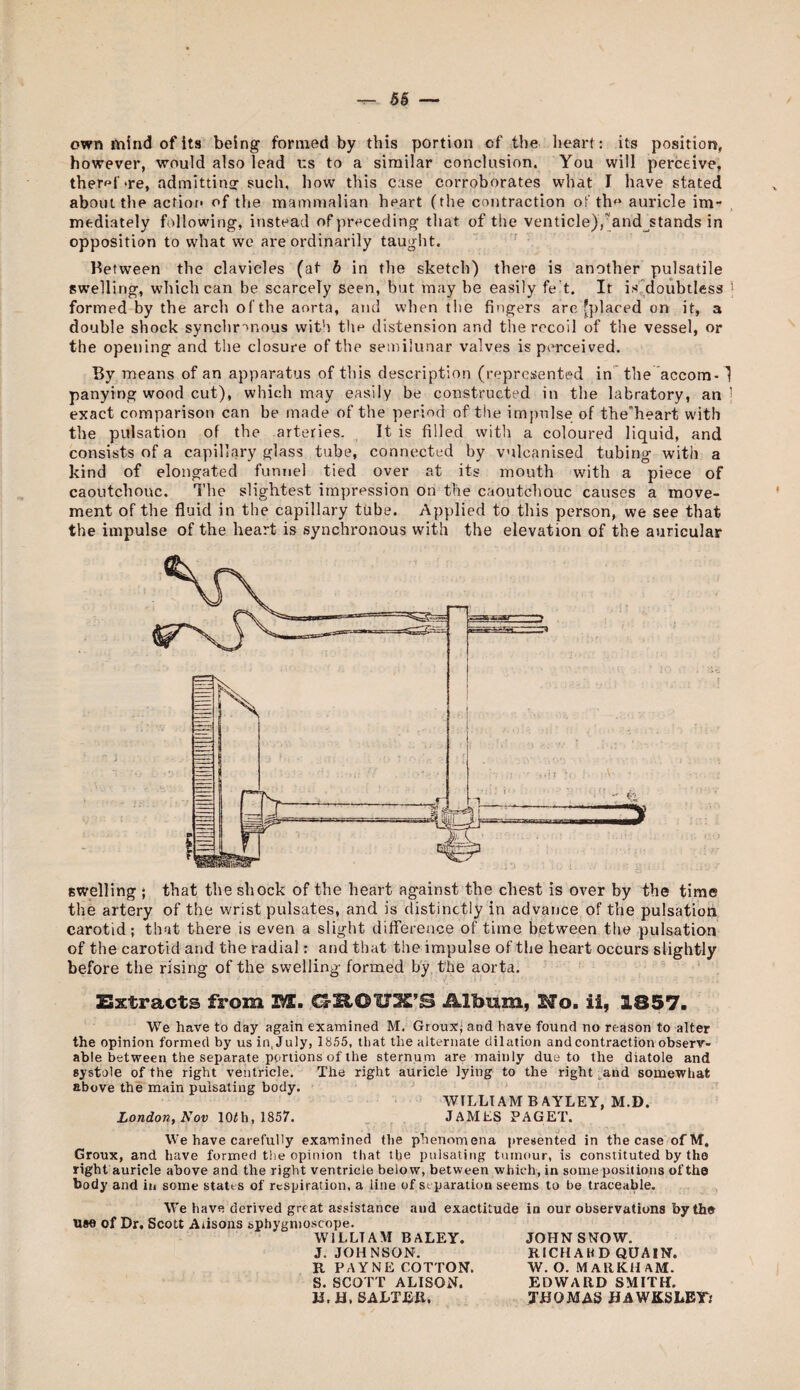 own mind of its being formed by this portion of the lieart: its position, however, would also lead us to a similar conclusion. You will perceive, ther^^f're, admittinsr such, how this case corroborates what I have stated about the action of the mammalian heart (the contraction of the auricle im¬ mediately following, instead of preceding that of tlie venticle),and_^stands in opposition to what we are ordinarily taught. '' Between the clavicles (at b in the sketch) there is another pulsatile swelling, which can be scarcely seen, but may be easily fe’t. It isMoubtless > formed by the arch of the aorta, and when the fingers are [placed on it, a double shock synchronous with tlie distension and the recoil of the vessel, or the opening and the closure of the semilunar valves is perceived. By means of an apparatus of this description (represented in~the accom-1 panying wood cut), which may easily be constructed in the labratory, an | exact comparison can be made of the period of the im])nlse of the^heart with the pulsation of the arteries. It is filled with a coloured liquid, and consists of a capillary glass tube, connected by vulcanised tubing with a kind of elongated funnel tied over at its mouth with a piece of caoutchouc. The slightest impression on the caoutchouc causes a move¬ ment of the fluid in the capillary tube. Applied to this person, we see that the impulse of the heart is synchronous with the elevation of the auricular swelling * that the shock of the heart against the chest is over by the time the artery of the wrist pulsates, and is distinctly in advance of the pulsation carotid; that there is even a slight difference of time between the pulsation of the carotid and the radial: and that the impulse of the heart occurs slightly before the rising of the swelling formed by the aorta. ' Extracts from Bl. G-ROUX’S Album, No. ii, 1857. We have to day again examined M. Groux} and have found no reason to alter the opinion formed by us in, July, 1855, that the alternate dilation and contraction observ¬ able between the separate portions of the sternum are mainly due to the diatole and systole of the right ventricle. The right auricle lying to the right ^and somewhat above the main pulsating body. WILLIAM BAYLEY, M.D. London, Nov lOih, 1857. JAMES PAGET. We have carefully examined the phenomena presented in the case ofM, Groux, and have formed the opinion that the pulsating tumour, is constituted by the right auricle above and the right ventricle below, between which, in some positions of the body and in some states of respiration, a line of separation seems to be traceable. We have derived great assistance and exactitude in our observations by the use of Dr, Scott Aiisons sphygnioscope. WILLIAM BALEY. JOHN SNOW. J. JOHNSON. RICHAHD QUAIN. R PAYNE COTTON. W. O. MARKHAM. S. SCOTT ALISON. EDWARD SMITH. JJ. H, SALTER, THOMAS HA WKSLEY:
