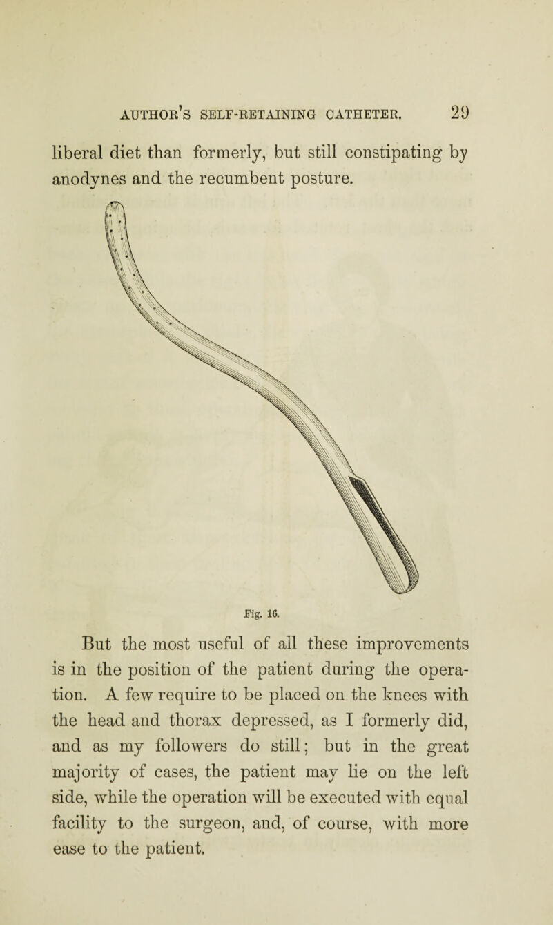 But the most useful of all these improvements is in the position of the patient during the opera¬ tion. A few require to be placed on the knees with the head and thorax depressed, as I formerly did, and as my followers do still; but in the great majority of cases, the patient may lie on the left side, while the operation will be executed with equal facility to the surgeon, and, of course, with more ease to the patient. rig. 16. author’s self-retaining catheter. 29 liberal diet than formerly, but still constipating by anodynes and the recumbent posture.