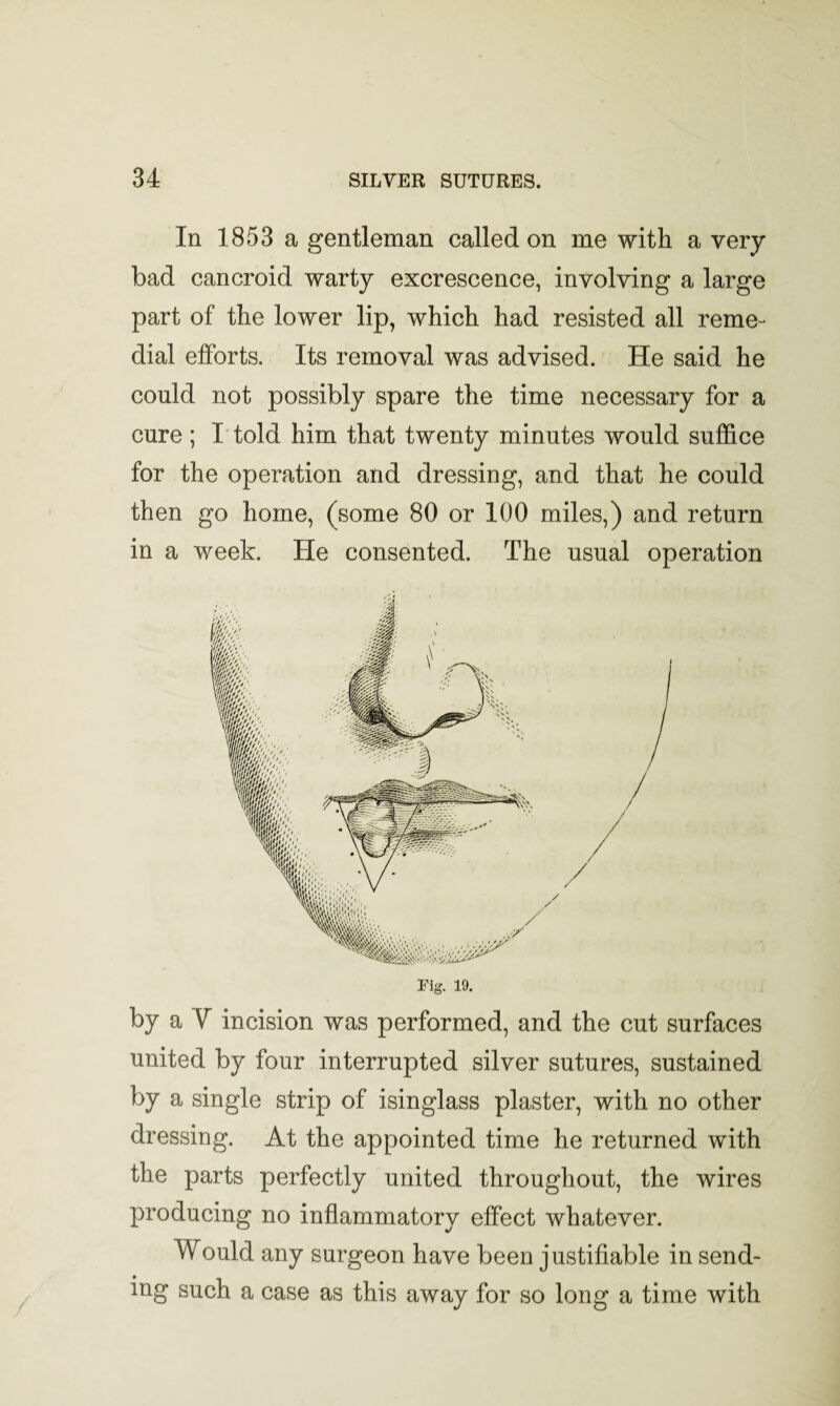 In 1853 a gentleman called on me with a very bad cancroid warty excrescence, involving a large part of the lower lip, which had resisted all reme¬ dial efforts. Its removal was advised. He said he could not possibly spare the time necessary for a cure ; I told him that twenty minutes would suffice for the operation and dressing, and that he could then go home, (some 80 or 100 miles,) and return in a week. He consented. The usual operation Fig. 19. by a Y incision was performed, and the cut surfaces united by four interrupted silver sutures, sustained by a single strip of isinglass plaster, with no other dressing. At the appointed time he returned with the parts perfectly united throughout, the wires producing no inflammatory effect whatever. Would any surgeon have been justiflable in send¬ ing such a case as this away for so long a time with