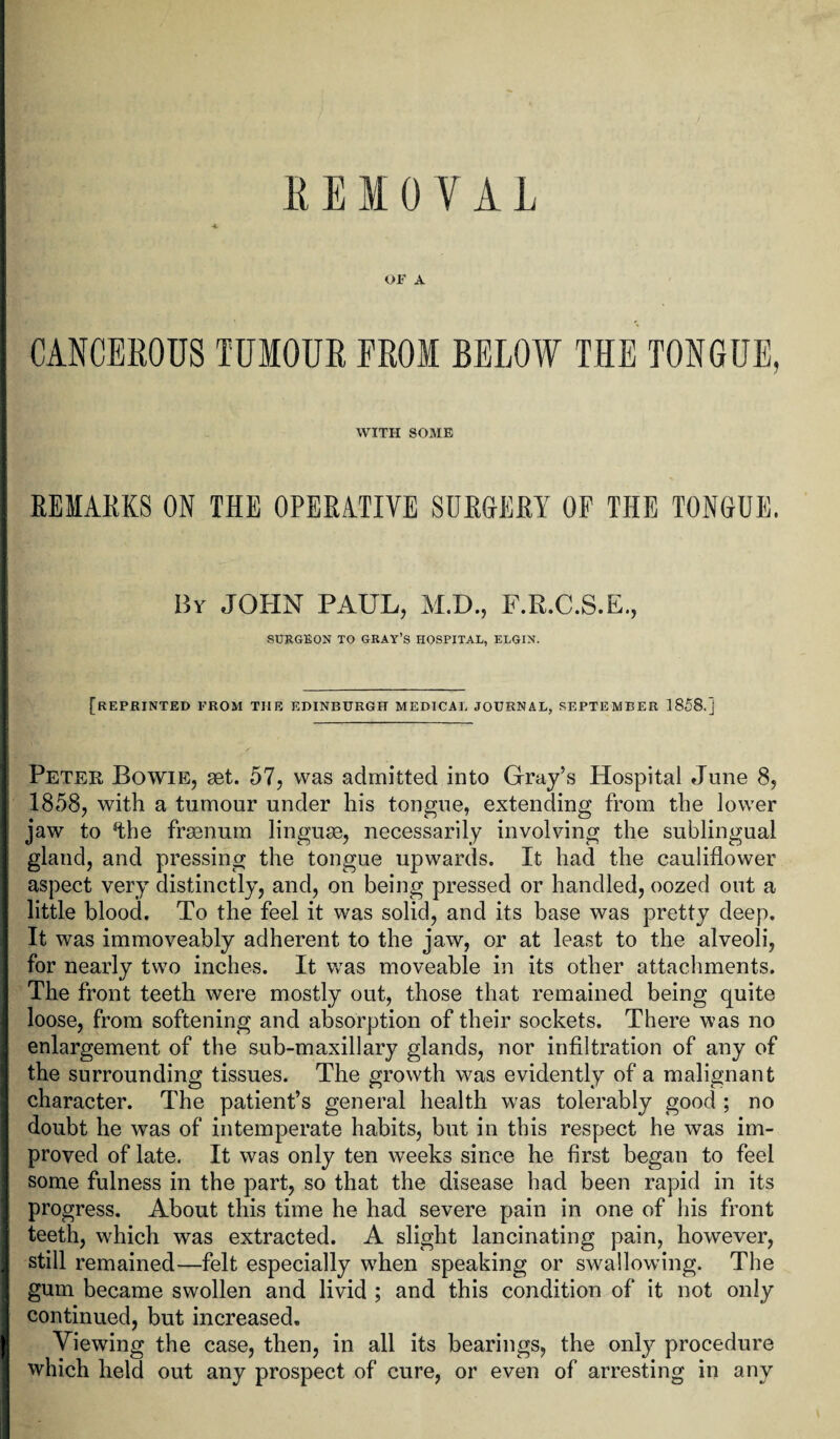 REMOVAL OF A CANCEROUS TUMOUR EROI BELOW THE TONGUE, WITH SOME REMARKS ON THE OPERATIVE SURGERY OF THE TONGUE. By JOHN PAUL, M.D., F.E.C.S.E., SURGEON TO GRAY’S HOSPITAL, ELGIN. [REPRINTED PROM THE EDINBURGH MEDICAL JOURNAL, SEPTEMBER 1858.] Peter Bowie, set. 57, was admitted into Gray’s Hospital June 8, 1858, with a tumour under his tongue, extending from the lower jaw to ftbe frsenum linguae, necessarily involving the sublingual gland, and pressing the tongue upwards. It had the cauliflower aspect very distinctly, and, on being pressed or handled, oozed out a little blood. To the feel it was solid, and its base was pretty deep. It was immoveably adherent to the jaw, or at least to the alveoli, for nearly two inches. It was moveable in its other attachments. The front teeth were mostly out, those that remained being quite loose, from softening and absorption of their sockets. There was no enlargement of the sub-maxillary glands, nor infiltration of any of the surrounding tissues. The growth was evidently of a malignant character. The patient’s general health was tolerably good ; no doubt he was of intemperate habits, but in this respect he was im¬ proved of late. It was only ten weeks since he first began to feel some fulness in the part, so that the disease had been rapid in its progress. About this time he had severe pain in one of his front teeth, which was extracted. A slight lancinating pain, however, still remained—felt especially when speaking or swallowing. The gum became swollen and livid ; and this condition of it not only continued, but increased. Viewing the case, then, in all its bearings, the only procedure which held out any prospect of cure, or even of arresting in any