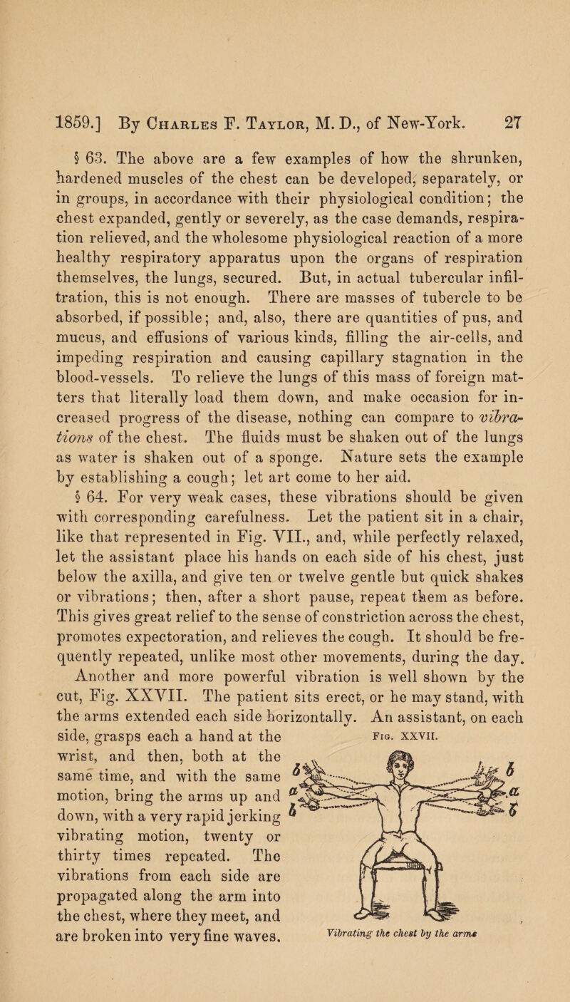 § 63. The above are a few examples of how the shrunken, hardened muscles of the chest can be developed; separately, or in groups, in accordance with their physiological condition; the chest expanded, gently or severely, as the case demands, respira¬ tion relieved, and the wholesome physiological reaction of a more healthy respiratory apparatus upon the organs of respiration themselves, the lungs, secured. But, in actual tubercular infil¬ tration, this is not enough. There are masses of tubercle to be absorbed, if possible; and, also, there are quantities of pus, and mucus, and effusions of various kinds, filling the air-cells, and impeding respiration and causing capillary stagnation in the blood-vessels. To relieve the lungs of this mass of foreign mat¬ ters that literally load them down, and make occasion for in¬ creased progress of the disease, nothing can compare to vibra¬ tions of the chest. The fluids must be shaken out of the lungs as water is shaken out of a sponge. Nature sets the example by establishing a cough; let art come to her aid. § 64. For very wrnak cases, these vibrations should be given with corresponding carefulness. Let the patient sit in a chair, like that represented in Fig. VII., and, while perfectly relaxed, let the assistant place his hands on each side of his chest, just below the axilla, and give ten or twelve gentle but quick shakes or vibrations; then, after a short pause, repeat them as before. This gives great relief to the sense of constriction across the chest, promotes expectoration, and relieves the cough. It should be fre¬ quently repeated, unlike most other movements, during the day. Another and more powerful vibration is well shown by the cut, Fig. XXVII. The patient sits erect, or he may stand, with the arms extended each side horizontally. An assistant, on each side, grasps each a hand at the fig. xxvii. wrist, and then, both at the same time, and with the same motion, bring the arms up and down, with a very rapid jerking vibrating motion, twenty or thirty times repeated. The vibrations from each side are propagated along the arm into the chest, where they meet, and are broken into Very fine Waves, Vibrating the chest by the arms