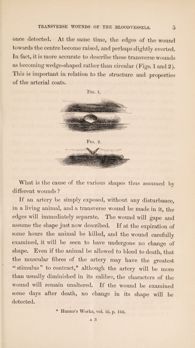 onc6 dotGctcd. At ttiG sarn© tiin©^ tli© edges of the wound towards the centre become raised, and perhaps slightly everted. In fact, it is more accurate to describe these transverse wounds as becoming wedge-shaped rather than circular (Figs. 1 and 2). This is important in relation to the structure and properties of the arterial coats. Fig. 1. What is the cause of the various shapes thus assumed by different wounds ? If an artery be simply exposed, without any disturbance, in a living animal, and a transverse wound be made in it, the edges will immediately separate. The wound will gape and assume the shape just now described. If at the expiration of some hours the animal be killed, and the wound carefully examined, it will be seen to have undergone no change of shape. Even if the animal be allowed to bleed to death, that the muscular fibres of the artery may have the greatest stimulus ” to contract,^ although the artery will be more than usually diminished in its calibre, the characters of the wound will remain unaltered. If the wound be examined some days after death, no change in its shape will be detected. * Hunter’s Works, vol. iii. p. 166.