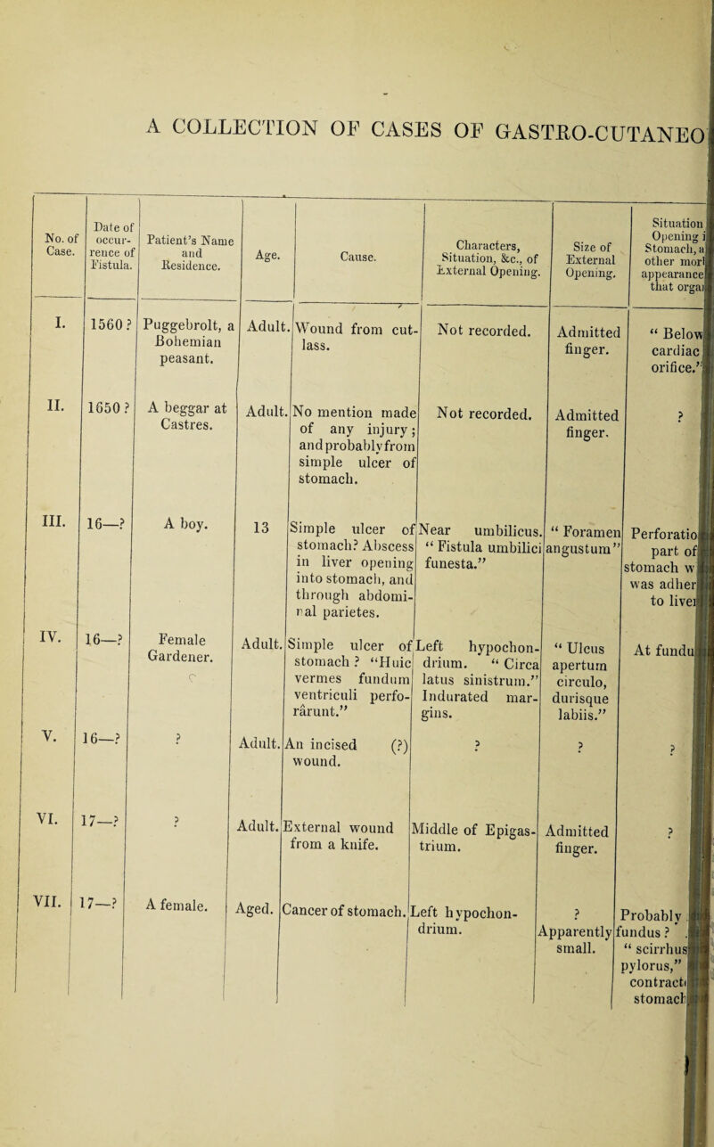 A COLLECTION OF CASES OF GASTRO-C UTANEO i No. of Case. Date o occur¬ rence Fistula f Patient’s Name f and Residence. Age. Cause. Characters, Situation, &c., of External Opening. Size of External Opening, Situation >1 Opening il Stomach, al other morlj appearance! that orgail I. 1560 Puggebrolt, a Bohemian peasant. Adult / • Wound from cut lass. Not recorded. Admitted finger. r “ Below! cardiac! orifice/'! II. 1650 ? A beggar at Castres. Adult No mention made of any injury; and probably from simple ulcer oi stomach. Not recorded. Admitted finger. p III. 16—? A boy. 13 Simple ulcer of stomach? Abscess in liver opening into stomach, and through abdomi¬ nal parietes. Near umbilicus. “ Fistula umbilici funesta.” “ Foramen angustum” Perforatiolj part of If stomach wifi was adher {.; to livei* HH <! 16—? Female Gardener. Adult. Simple ulcer of stomach? “Huic vermes fundum ventriculi perfo- rarunt.” Left hypochon- drium. “ Circa latus sinistrum.” Indurated mar¬ gins. “ Ulcus aperturn circulo, durisque labiis.” 1 At fundu Jill Y. 16—? ? Adult. An incised (?) wound. p ■fl 1 VI. 17—? p Adult. External wound from a knife. Vliddle of Epigas¬ trium. Admitted finger. > ii VII. i 17—? A female. Aged. ( dancer of stomach. 1 . .jeft hypochon- drium. i p Apparently f small. i! Probably ,\i.'[f) undus ? .ft “ scirrhusH pylorus,” A contract! ■: stomach!!1