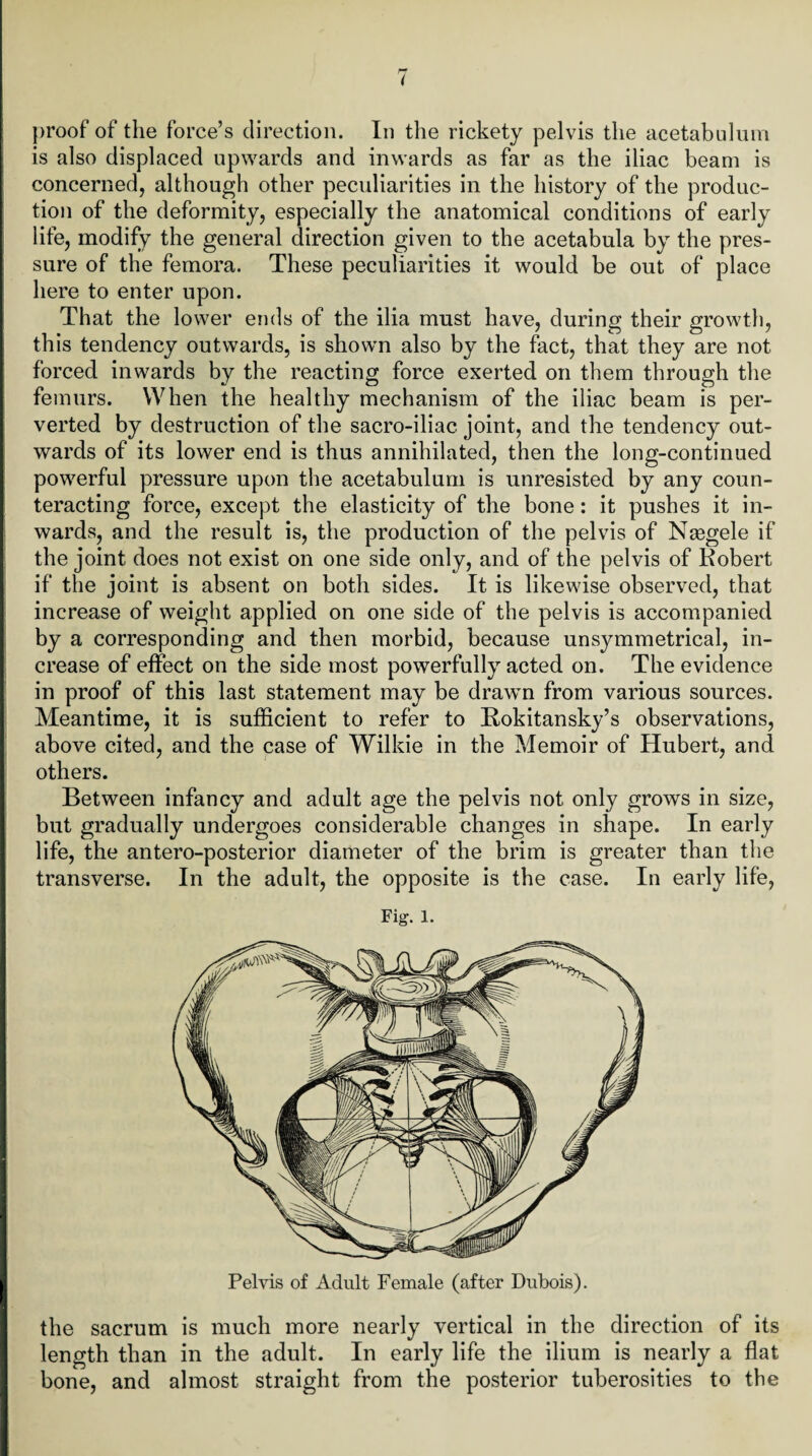 proof of the force’s direction. In the rickety pelvis the acetabulum is also displaced upwards and inwards as far as the iliac beam is concerned, although other peculiarities in the history of the produc¬ tion of the deformity, especially the anatomical conditions of early life, modify the general direction given to the acetabula by the pres¬ sure of the femora. These peculiarities it would be out of place here to enter upon. That the lower ends of the ilia must have, during their growth, this tendency outwards, is shown also by the fact, that they are not forced inwards by the reacting force exerted on them through the femurs. When the healthy mechanism of the iliac beam is per¬ verted by destruction of the sacro-iliac joint, and the tendency out¬ wards of its lower end is thus annihilated, then the long-continued powerful pressure upon the acetabulum is unresisted by any coun¬ teracting force, except the elasticity of the bone: it pushes it in¬ wards, and the result is, the production of the pelvis of Nasgele if the joint does not exist on one side only, and of the pelvis of Robert if the joint is absent on both sides. It is likewise observed, that increase of weight applied on one side of the pelvis is accompanied by a corresponding and then morbid, because unsymmetrical, in¬ crease of effect on the side most powerfully acted on. The evidence in proof of this last statement may be drawn from various sources. Meantime, it is sufficient to refer to Rokitansky’s observations, above cited, and the case of Wilkie in the Memoir of Hubert, and others. Between infancy and adult age the pelvis not only grows in size, but gradually undergoes considerable changes in shape. In early life, the antero-posterior diameter of the brim is greater than the transverse. In the adult, the opposite is the case. In early life, Fig. 1. Pelvis of Adult Female (after Dubois). the sacrum is much more nearly vertical in the direction of its length than in the adult. In early life the ilium is nearly a flat bone, and almost straight from the posterior tuberosities to the