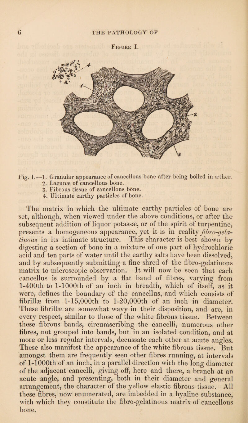 Figure I. Fig. L—1. Granular appearance of cancellous bone after being boiled in aether, 2. Lacunae of cancellous bone. 3. Fibrous tissue of cancellous bone. 4. Ultimate earthy particles of bone. The matrix in which the ultimate earthy particles of bone are set, although, when viewed under the above conditions, or after the subsequent addition of liquor potassse, or of the spirit of turpentine, presents a homogeneous appearance, yet it is in reality fibro-gela- tinous in its intimate structure. This character is best shown by digesting a section of bone in a mixture of one part of hydrochloric acid and ten parts of water until the earthy salts have been dissolved, and by subsequently submitting a fine shred of the fibro-gelatinous matrix to microscopic observation. It will now be seen that each cancellus is surrounded by a flat band of fibres, varying from l-400th to 1-lOOOlh of an inch in breadth, which of itself, as it were, defines the boundary of the cancellus, and which consists of fibrillae from 1-15,000th to 1-20,000th of an inch in diameter. These fibrillge are somewhat wavy in their disposition, and are, in every respect, similar to those of the white fibrous tissue. Between these fibrous bands, circumscribing the cancelli, numerous other fibres, not grouped into bands, but in an isolated condition, and at more or less regular intervals, decussate each other at acute angles. These also manifest the appearance of the white fibrous tissue. But amongst them are frequently seen other fibres running, at intervals of 1-1000th of an inch, in a parallel direction with the long diameter of the adjacent cancelli, giving off, here and there, a branch at an acute angle, and presenting, both in their diameter and general arrangement, the character of the yellow elastic fibrous tissue. All these fibres, now enumerated, are imbedded in a hyaline substance, with which they constitute the fibro-gelatinous matrix of cancellous bone.