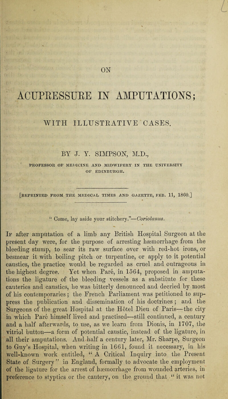 ON ACUPRESSURE IN AMPUTATIONS; WITH ILLUSTRATIVE CASES. BY J. Y. SIMPSON, M.D., PROFESSOR OF MEDICINE AND MIDWIFERY IN THE UNIVERSITY OF EDINBURGH. [REPRINTED FROM THE MEDICAL TIMES AND GAZETTE, FEB. 11, I860.] “ Come, lay aside your stitchery.”—Coriolanus. If after amputation of a limb any British Hospital Surgeon at the present day were, for the purpose of arresting haemorrhage from the bleeding stump, to sear its raw surface over with red-hot irons, or besmear it with boiling pitch or turpentine, or apply to it potential caustics, the practice would be regarded as cruel and outrageous in the highest degree. Yet when Pare, in 1564, proposed in amputa¬ tions the ligature of the bleeding vessels as a substitute for these cauteries and caustics, he was bitterly denounced and decried by most of his contemporaries; the French Parliament was petitioned to sup¬ press the publication and dissemination of his doctrines ; and the Surgeons of the great Hospital at the Hotel Dieu of Paris—the city in which Pare himself lived and practised—still continued, a century and a half afterwards, to use, as we learn from Dionis, in 1707, the vitriol button—a form of potential caustic, instead of the ligature, in all their amputations. And half a century later, Mr. Sharpe, Surgeon to Guy’s Hospital, when writing in 1661, found it necessary, in his well-known work entitled, u A Critical Inquiry into the Present State of Surgery” in England, formally to advocate the employment of the ligature for the arrest of haemorrhage from wounded arteries, in preference to styptics or the cautery, on the ground that “ it was not