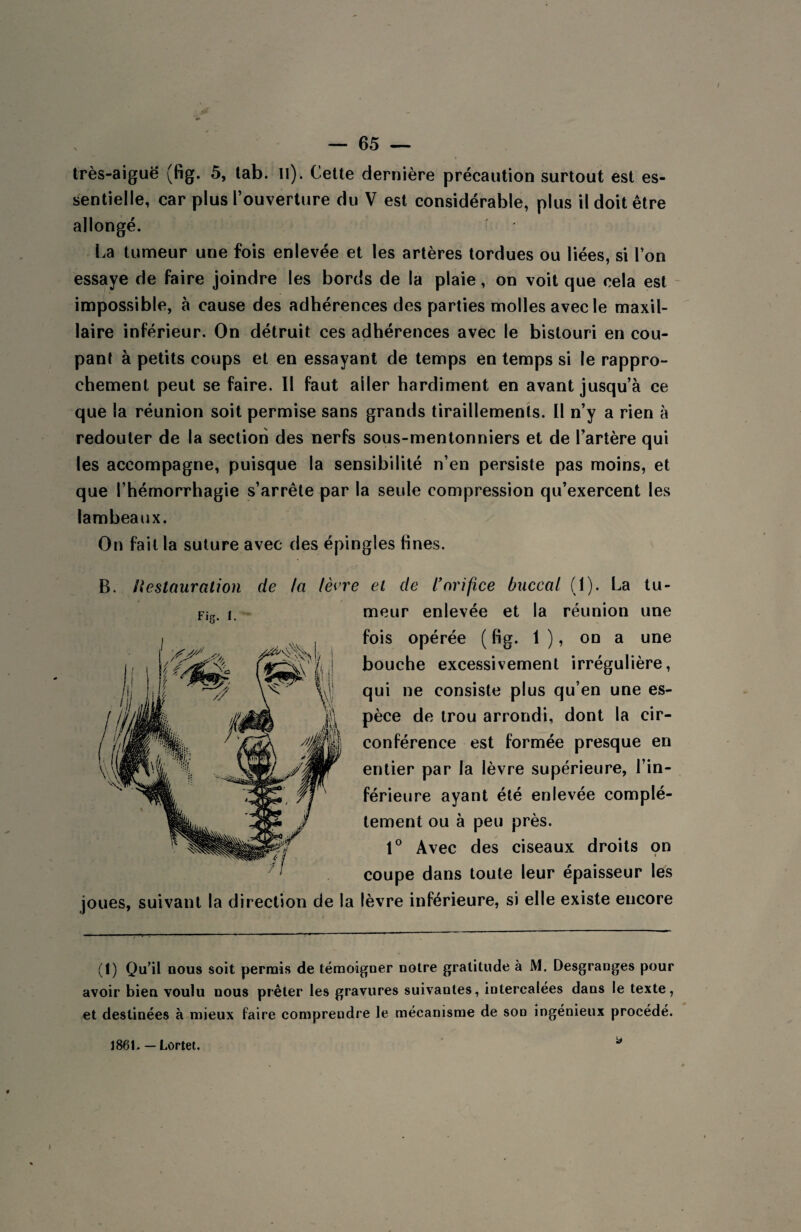 sentielle, car plus l’ouverture du V est considérable, P' us il doit être allongé. La tumeur une fois enlevée et les artères tordues ou liées, si l’on essaye de faire joindre les bords de la plaie, on voit que cela est impossible, à cause des adhérences des parties molles avec le maxil¬ laire inférieur. On détruit ces adhérences avec le bistouri en cou¬ pant à petits coups et en essayant de temps en temps si le rappro- chement peut se faire. Il faut aller hardiment en avant jusqu’à ce que la réunion soit permise sans grands tiraillements. Il n’y a rien à redouter de la section des nerfs sous-mentonniers et de l’artère qui les accompagne, puisque la sensibilité n’en persiste pas moins, et que l’hémorrhagie s’arrête par la seule compression qu’exercent les lambeaux. On fait la suture avec des épingles fines. B. Restauration de la lèe Fig. I. joues, suivant la direction de et de l’orifice buccal (1). La tu¬ meur enlevée et la réunion une fois opérée ( fig. 1 ), on a une bouche excessivement irrégulière, qui ne consiste plus qu’en une es¬ pèce de trou arrondi, dont la cir¬ conférence est formée presque en entier par la lèvre supérieure, l’in¬ férieure ayant été enlevée complè¬ tement ou à peu près. 1° Avec des ciseaux droits on coupe dans toute leur épaisseur les lèvre inférieure, si elle existe encore (1) Qu’il nous soit permis de témoigner notre gratitude à M. Desgranges pour avoir bien voulu nous prêter les gravures suivantes, intercalées dans le texte, et destinées à mieux faire comprendre le mécanisme de son ingénieux procédé. y 1861. — Lortet.