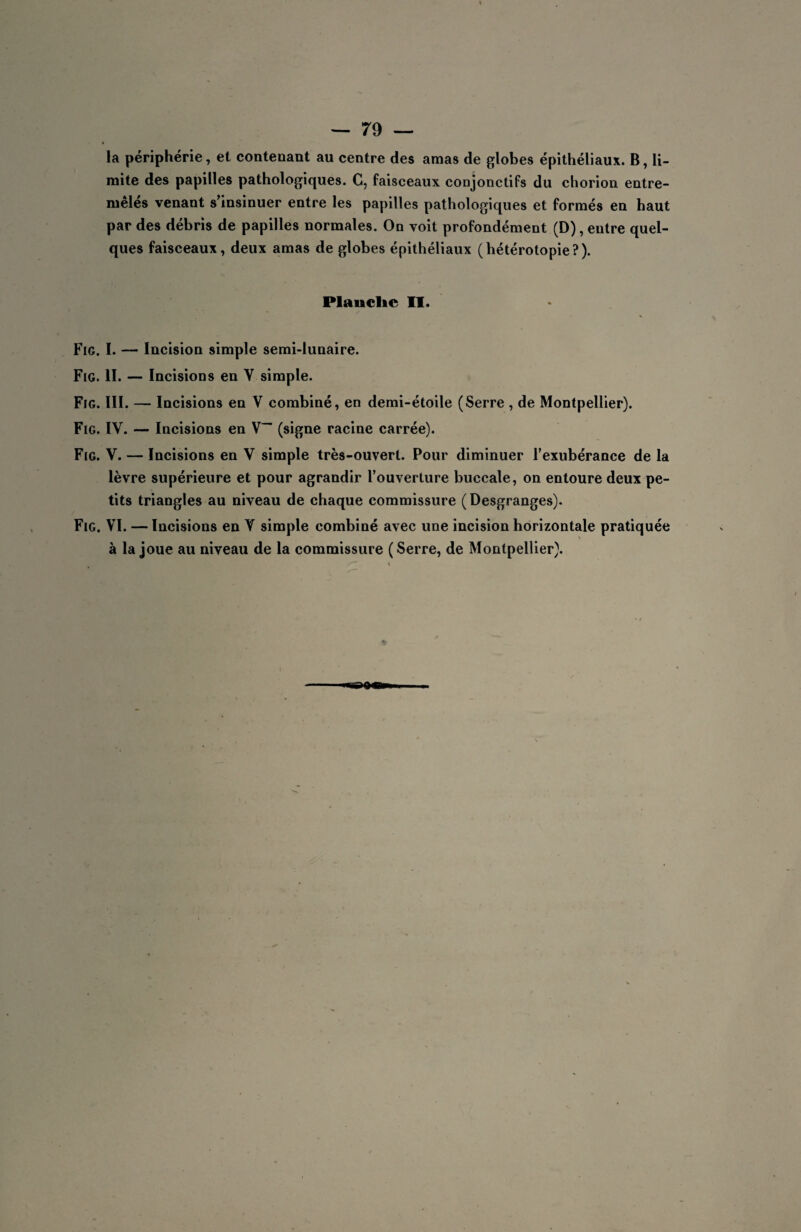• la périphérie, et contenant au centre des amas de globes épithéliaux. B, li¬ mite des papilles pathologiques. C, faisceaux conjonctifs du chorion entre¬ mêlés venant s’insinuer entre les papilles pathologiques et formés en haut par des débris de papilles normales. On voit profondément (D), entre quel¬ ques faisceaux, deux amas de globes épithéliaux (hétérotopie?). Plauclie II. \ Fig. I. — Incision simple semi-lunaire. Fig. II. — Incisions en V simple. Fig. III. — Incisions en V combiné, en demi-étoile (Serre , de Montpellier). Fig. IV. — Incisions en V (signe racine carrée). Fig. V. — Incisions en V simple très-ouvert. Pour diminuer l’exubérance de la lèvre supérieure et pour agrandir l’ouverture buccale, on entoure deux pe¬ tits triangles au niveau de chaque commissure (Desgranges). Fig. VI. — Incisions en Y simple combiné avec une incision horizontale pratiquée à la joue au niveau de la commissure ( Serre, de Montpellier).