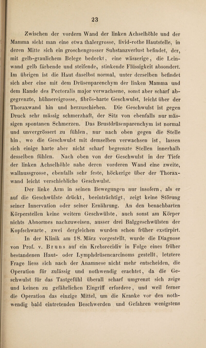 Zwischen der vordem Wand der linken Achselhöhle und der Mamma sieht man eine etwa thalergrosse, livid-rothe Hautstelle, in deren Mitte sich ein groschengrosser Substanzverlust befindet, der, mit gelb-graulichem Belege bedeckt, eine wässerige, die Lein¬ wand gelb färbende und steifende, stinkende Flüssigkeit absondert. Im übrigen ist die Haut daselbst normal, unter derselben befindet sich aber eine mit dem Drüsenparenchym der linken Mamma und dem Rande des Pectoralis major verwachsene, sonst aber scharf ab¬ gegrenzte, hühnereigrosse, fibrös-harte Geschwulst, leicht über der Thoraxwand hin und herzuschieben. Die Geschwulst ist gegen Druck sehr mässig schmerzhaft, der Sitz von ebenfalls nur mäs- sigen spontanen Schmerzen. Das Brustdrüsenparenchym ist normal und unvergrössert zu fühlen, nur nach oben gegen die Stelle hin, wo die Geschwulst mit demselben verwachsen ist, lassen sich einige harte aber nicht scharf begrenzte Stellen innerhalb desselben fühlen. Nach oben von der Geschwulst in der Tiefe der linken Achselhöhle nahe deren vorderen Wand eine zweite, wallnussgrosse, ebenfalls sehr feste, höckerige über der Thorax- w^and leicht verschiebliche Geschwulst. Der linke Arm in seinen Bewegungen nur insofern, als er auf die Geschwülste drückt, beeinträchtigt, zeigt keine Störung seiner Innervation oder seiner Ernährung. An den benachbarten Körperstellen keine weitern Geschwülste, auch sonst am Körper nichts Abnormes nachzuweisen, ausser drei Balggeschwülsten der Kopfschwarte, zwei dergleichen wurden schon früher exstirpirt. In der Klinik am 18. März vorgestellt, wurde die Diagnose von Prof. v. Bruns auf ein Krebsrecidiv in Folge eines früher bestandenen Haut- oder Lymphdrüsencarcinoms gestellt, letztere Frage liess sich nach der Anamnese nicht mehr entscheiden, die Operation für zulässig und nothwendig erachtet, da die Ge¬ schwulst für das Tastgefühl überall scharf umgrenzt sich zeige und keinen zu gefährlichen Eingriff erfordere, und weil ferner die Operation das einzige Mittel, um die Kranke vor den noth¬ wendig bald eintretenden Beschwerden und Gefahren wenigstens