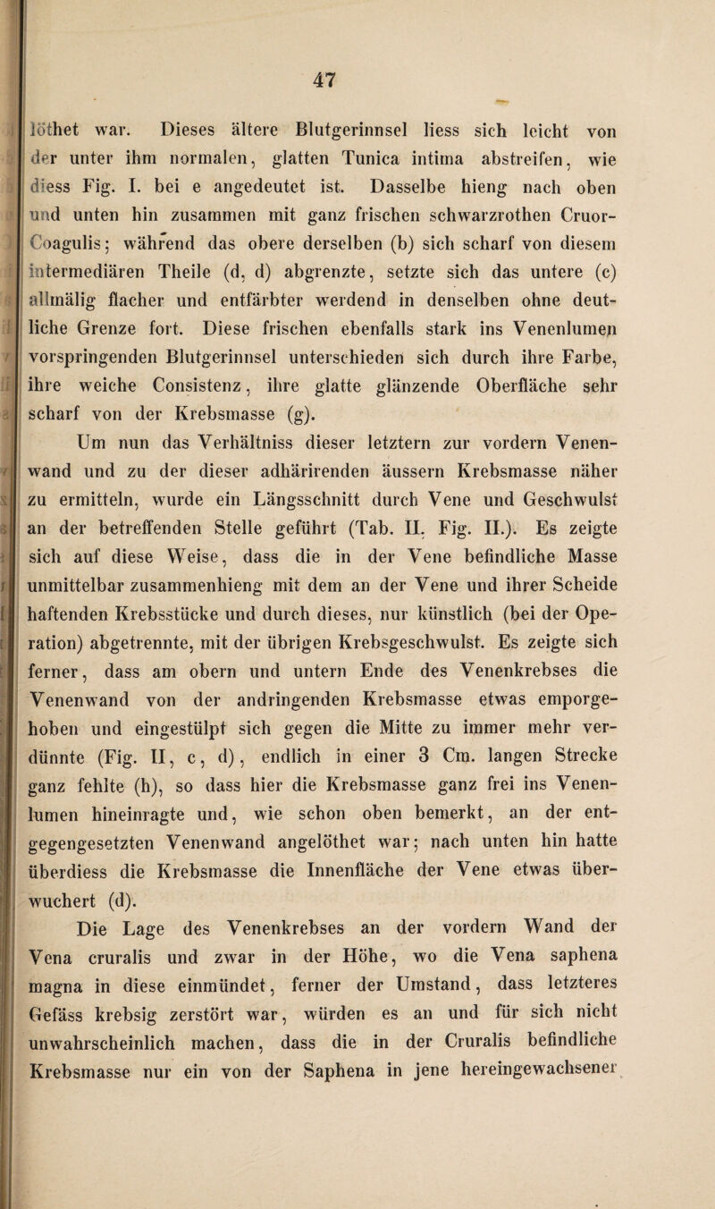 lothet war. Dieses ältere Blutgerinnsel liess sich leicht von der unter ihm normalen, glatten Tunica intima abstreifen, wie diess Fig. I. bei e angedeutet ist. Dasselbe hieng nach oben und unten hin zusammen mit ganz frischen schwarzrothen Cruor- Coagulis; während das obere derselben (b) sich scharf von diesem intermediären Theile (d, d) abgrenzte, setzte sich das untere (c) allmälig flacher und entfärbter werdend in denselben ohne deut¬ liche Grenze fort. Diese frischen ebenfalls stark ins Venenlumeji vorspringenden Blutgerinnsel unterschieden sich durch ihre Farbe, ihre weiche Consistenz, ihre glatte glänzende Oberfläche sehr scharf von der Krebsmasse (g). Um nun das Verhältniss dieser letztem zur vordem Venen¬ wand und zu der dieser adhärirenden äussern Krebsmasse näher zu ermitteln, wurde ein Längsschnitt durch Vene und Geschwulst an der betreffenden Stelle geführt (Tab. II, Fig. II.). Es zeigte sich auf diese Weise, dass die in der Vene befindliche Masse unmittelbar zusammenhieng mit dem an der Vene und ihrer Scheide haftenden Krebsstücke und durch dieses, nur künstlich (bei der Ope¬ ration) abgetrennte, mit der übrigen Krebsgeschwulst. Es zeigte sich ferner, dass am obern und untern Ende des Venenkrebses die Venenwand von der andringenden Krebsmasse etwas emporge¬ hoben und eingestülpt sich gegen die Mitte zu immer mehr ver¬ dünnte (Fig. II, c, d), endlich in einer 3 Cm. langen Strecke ganz fehlte (h), so dass hier die Krebsmasse ganz frei ins Venen¬ lumen hineinragte und, wie schon oben bemerkt, an der ent¬ gegengesetzten Venenwand angelöthet war; nach unten hin hatte überdiess die Krebsmasse die Innenfläche der Vene etwas über¬ wuchert (d). Die Lage des Venenkrebses an der vordem Wand der Vena cruralis und zwar in der Höhe, wo die Vena saphena magna in diese einmündet, ferner der Umstand, dass letzteres Gefäss krebsig zerstört war, würden es an und für sich nicht unwahrscheinlich machen, dass die in der Cruralis befindliche Krebsmasse nur ein von der Saphena in jene hereingewachsener