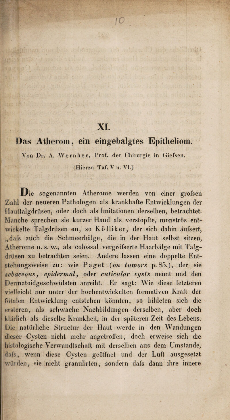 Das Atherom, ein eingebalgtes Epitheliom. Von Dr. A. Wern her, Prof, der Chirurgie in Giefsen. (Hierzu Taf. V u. VI.) Die sogenannten Atherome werden von einer grofsen Zahl der neueren Pathologen als krankhafte Entwicklungen der Hauttalgdrüsen, oder doch als Imitationen derselben, betrachtet. Manche sprechen sie kurzer Hand als verstopfte, monströs ent¬ wickelte Talgdrüsen -an, so Kölliker, der sich dahin äufsert, „dafs auch die Schmeerbälge, die in der Haut selbst sitzen, Atherome u. s. w., als colossal vergröfserte Haarbälge mit Talg¬ drüsen zu betrachten seien. Andere lassen eine doppelte Ent¬ stehungsweise zu: wie Paget {on iiimors p. 85.), der sie sehaceons, epldermaly oder ciiticiilar cijsts nennt und den Dermatoidgeschwülsten anreiht. Er sagt: Wie diese letzteren vielleicht nur unter der hochentwickelten formativen Kraft der fötalen Entwicklung entstehen könnten, so bildeten sich die ; ersteren, als schwache Nachbildungen derselben, aber doch 1 klärlich als dieselbe Krankheit, in der späteren Zeit des Lebens. Die natürliche Structur der Haut werde in den Wandungen dieser Cysten nicht mehr angetroffen, doch erweise sich die i histologische Verwandtschaft mit derselben aus dem Umstande, j dafs, wenn diese Cysten geöffnet und der Luft ausgesetzt I würden, sie nicht granulirten, sondern dafs dann ihre innere