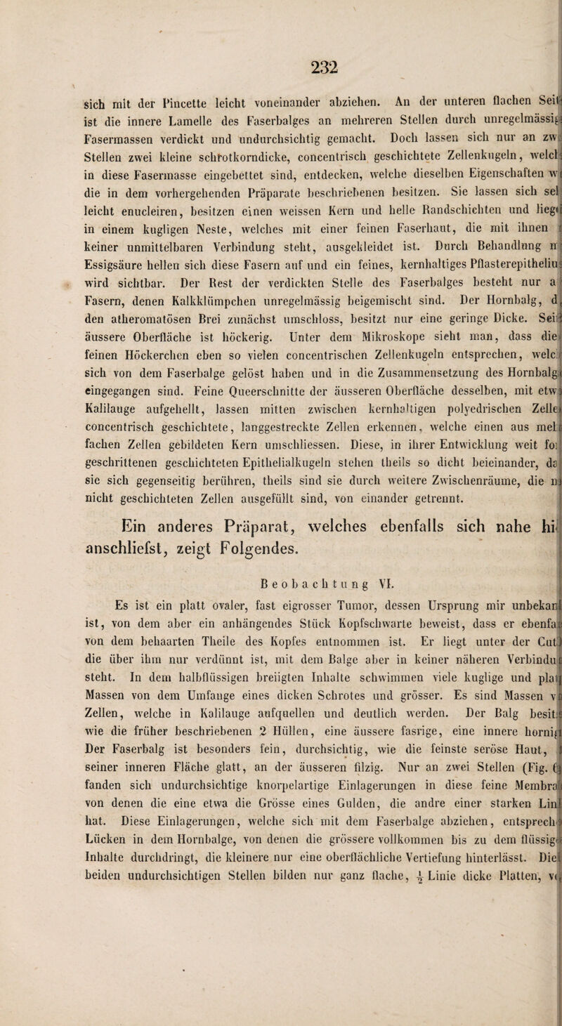 sich mit der Pincette leicht voneinander ahziehen. An der unteren flachen Seil^ ist die innere Lamelle des Faserbalges an mehreren Stellen durch unregelmässig^ Fasermassen verdickt und undurchsichtig gemacht. Doch lassen sich nur an zw! Stellen zwei kleine schfotkorndicke, concentrisch geschichtete Zellenkugeln, welcL in diese Faserinasse eingebettet sind, entdecken, welche dieselben Eigenschaften wj die in dem vorhergehenden Präparate beschriebenen besitzen. Sie lassen sich sek leicht enucleiren, besitzen einen weissen Kern und helle Randschichten und liegt! in einem kugligen Neste, welches mit einer feinen Faserhaiit, die mit ihnen i keiner unmittelbaren Verbindung steht, ausgekleidet ist. Durch Behandlung ir; Essigsäure hellen sieh diese Fasern auf und ein feines, kernhaltiges Pflasterepitheliuj wird sichtbar. Der Rest der verdickten Stelle des Faserbalges besteht nur a' Fasern, denen Kalkklümpchen unregelmässig beigemischt sind. Der Hornbalg, d, den atheromatösen Brei zunächst umschloss, besitzt nur eine geringe Dicke. Seiil äussere Oberfläche ist höckerig. Unter dem Mikroskope sieht man, dass die- feinen Höckerchen eben so vielen concentrischen Zellenkugeln entsprechen, welc sich von dem Faserbalge gelöst haben und in die Zusammensetzung des Hornbalg,i eingegangen sind. Feine Queerschnitte der äusseren Oberfläche desselben, mit etw^ Kalilauge aufgehellt, lassen mitten zwischen kernhoUigen polyedrischea Zellei concentrisch geschichtete, langgestreckte Zellen erkennen, welche einen aus melj fachen Zellen gebildeten Kern umschliessen. Diese, in ihrer Entwicklung weit fo] geschrittenen geschichteten Epithelialkiigeln stehen theils so dicht beieinander, ds sie sich gegenseitig berühren, theils sind sie durch weitere Zwischenräume, die n) nicht geschichteten Zellen ausgefüllt sind, von einander getrennt. Ein anderes Präparat, welches ebenfalls sich nahe hi anschliefst, zeigt Folgendes. Beobachtung VI. Es ist ein platt ovaler, fast eigrosser Tumor, dessen Ursprung mir unbekanl ist, von dem aber ein anhängendes Stück Kopfschwarte beweist, dass er ebenfal von dem behaarten Theile des Kopfes entnommen ist. Er liegt unter der CuÜ die über ihm nur verdünnt ist, mit dem Balge aber in keiner näheren Verbinduii steht. In dem halbflüssigen breiigten Inhalte schwimmen viele kuglige und plai| Massen von dem Umfange eines dicken Schrotes und grosser. Es sind Massen vß Zellen, welche in Kalilauge anfquellen und deutlich werden. Der Balg besit;6 wie die früher beschriebenen 2 Hüllen, eine äussere fasrige, eine innere hornigi Der Faserbalg ist besonders fein, durchsichtig, wie die feinste seröse Haut, .3 seiner inneren Fläche glatt, an der äusseren filzig. Nur an zwei Stellen (Fig. fanden sich undurchsichtige knorpelartige Einlagerungen in diese feine Membrä'i von denen die eine etwa die Grösse eines Gulden, die andre einer starken LinJ hat. Diese Einlagerungen, welche sich mit dem Faserbalge abziehen, cntspreclr^ Lücken in dem Hornbalge, von denen die grössere vollkommen bis zu dem flüssigem Inhalte durchdringt, die kleinere nur eine oberflächliche Vertiefung hinterlässt. Diel beiden undurchsichtigen Stellen bilden nur ganz flache, Linie dicke Platten, V((