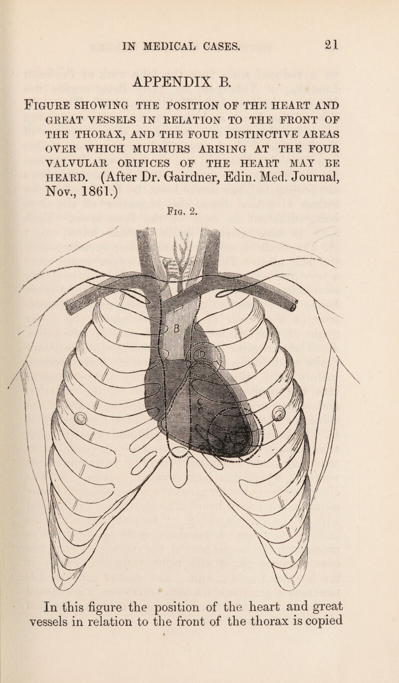 APPENDIX B. Figure showing the position of the heart and GREAT VESSELS IN RELATION TO THE FRONT OF THE THORAX, AND THE FOUR DISTINCTIVE AREAS OVER WHICH MURMURS ARISING AT THE FOUR VALVULAR ORIFICES OF THE HEART MAY BE heard. (After Dr. Gairdner, Edin. Med. Journal, Nov., 1861.) Fig. 2. Xfcs ■ . W In this figure the position of the heart and great vessels in relation to the front of the thorax is copied