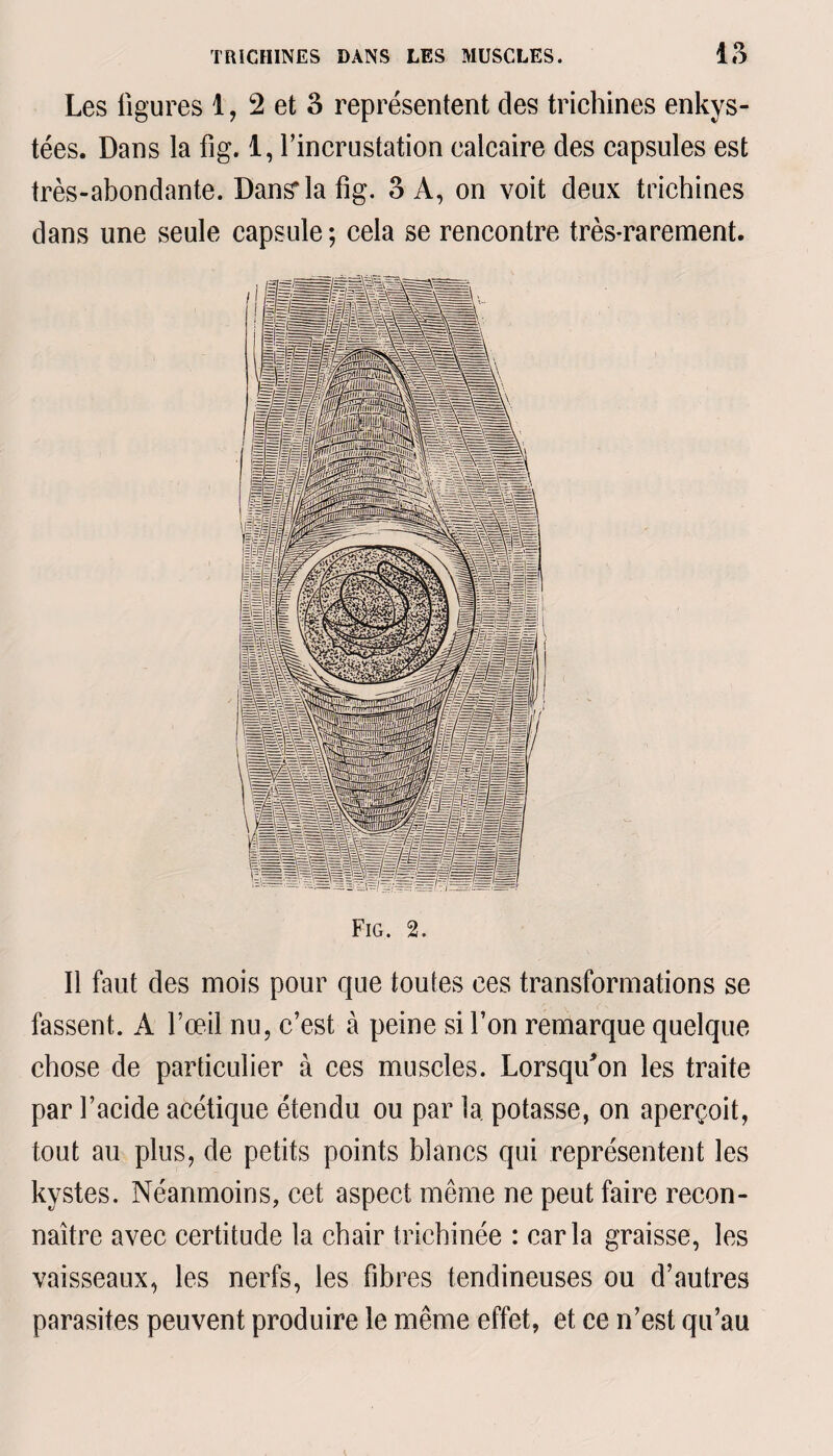 Les ligures 1, 2 et 3 représentent des trichines enkys¬ tées. Dans la fig. 1, l’incrustation calcaire des capsules est très-abondante. Dansia fig. 3 A, on voit deux trichines dans une seule capsule; cela se rencontre très-rarement. Fig. 2. Il faut des mois pour que toutes ces transformations se fassent. A l’œil nu, c’est à peine si l’on remarque quelque chose de particulier à ces muscles. Lorsqu'on les traite par l’acide acétique étendu ou par la potasse, on aperçoit, tout au plus, de petits points blancs qui représentent les kystes. Néanmoins, cet aspect meme ne peut faire recon¬ naître avec certitude la chair trichinée : caria graisse, les vaisseaux, les nerfs, les fibres tendineuses ou d’autres parasites peuvent produire le même effet, et ce n’est qu’au