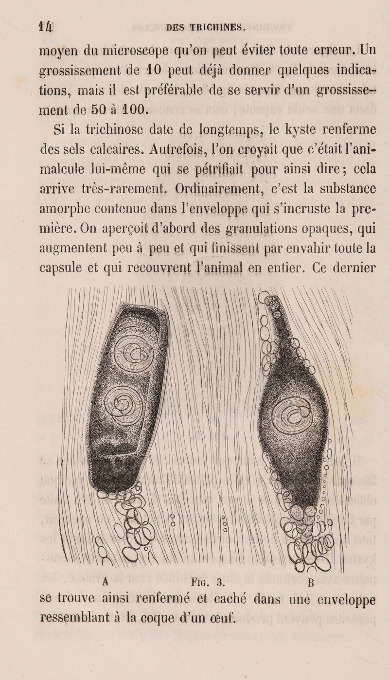 moyen du microscope qu’on peut éviter toute erreur. Un grossissement de 10 peut déjà donner quelques indica¬ tions, mais il est préférable de se servir d’un grossisse- ment de 50 à 100. Si la trichinose date de longtemps, le kyste renferme des sels calcaires. Autrefois, l’on croyait que c’était Tani- malcule lui-même qui se pétrifiait pour ainsi dire; cela arrive très-rarement. Ordinairement, c’est la substance amorphe contenue dans l’enveloppe qui s’incruste la pre¬ mière. On aperçoit d’abord des granulations opaques, qui augmentent peu à peu et qui finissent par envahir toute la capsule et qui recouvrent Fanimal en entier. Ce dernier A Fig. 3. B se trouve ainsi renfermé et caché dans une enveloppe ressemblant à la coque d’un œuf.