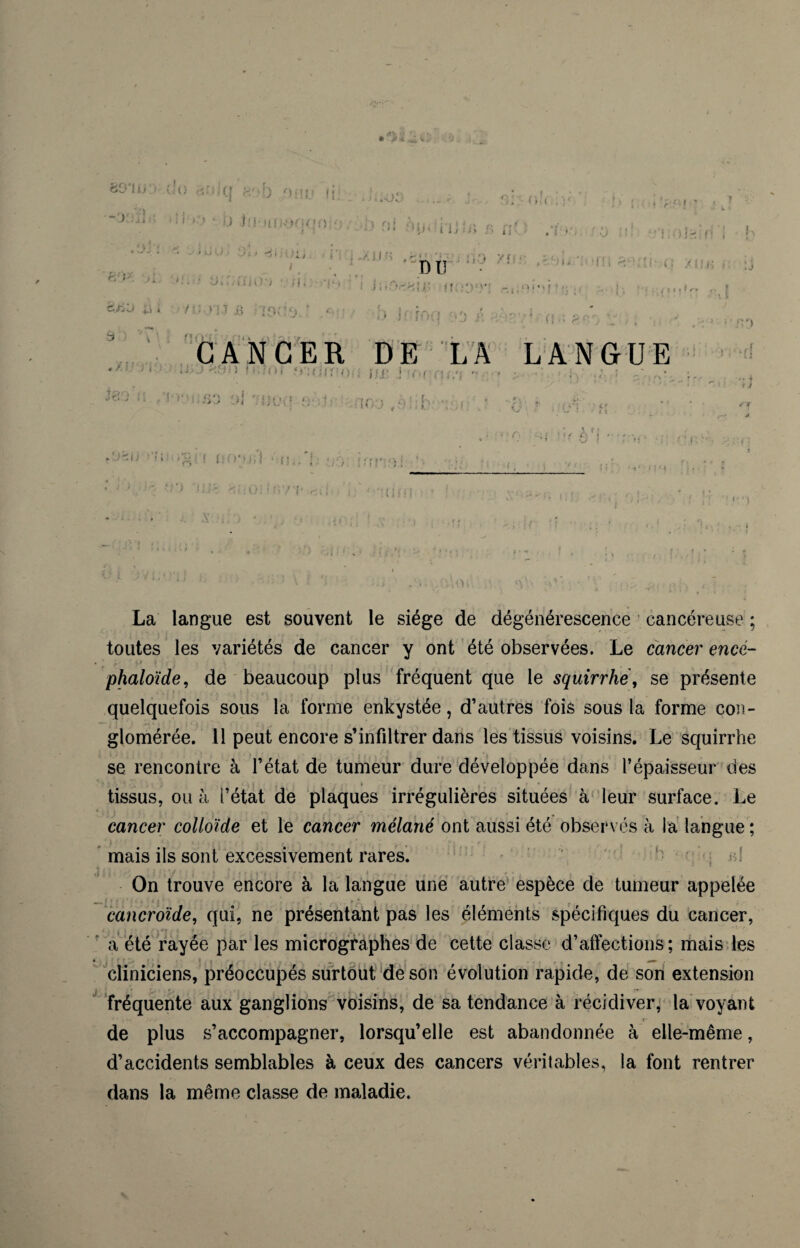 ’àO'l U ! • (.'o (f fi'ib U* fi. J' ui * > ; ! ■ U I:! m[k*>c>n<) •) • ’ ii ' ' . J- : a •»!>.; (Si > i; {•. ' • £ , i . 1 b'u • n'i •»-% ■ . j; ■V fl « . /• ' t ' f\ > . l i j ; ï > /> i! . i O S.OiHif'! DU- ./in?; .i C.Jj . /C-Li.î £ <) J f ■ rr»/ î cir i i • •;. , f> • * « f! : r CANCER DE LA LANGUE - - « > ^ O y 1 f * V ' 1 i.\ 1 - J .J 1}{ 4 î •, 1 h, *. ’ ' ' (v . f ! : f ! ■ ’ •, 1 ‘ r K,’ A C è?j * . ! ■ i , ! j î ' > r >ll r. + ri fï : La langue est souvent le siège de dégénérescence cancéreuse ; toutes les variétés de cancer y ont été observées. Le cancer encé- '.' ■J».»» ; '-, \ ■ . . \ • * . • . \ , ... phaloïde, de beaucoup plus fréquent que le squirrhe, se présente quelquefois sous la forme enkystée, d’autres fois sous la forme con¬ glomérée. Il peut encore s’infiltrer dans les tissus voisins. Le squirrhe se rencontre à l’état de tumeur dure développée dans l’épaisseur des i . • » tissus, ou à l’état de plaques irrégulières situées à leur surface. Le cancer colloïde et le cancer mélané ont aussi été observés à la langue ; mais ils sont excessivement rares. On trouve encore à la langue une autre espèce de tumeur appelée cancroïde, qui, ne présentant pas les éléments spécifiques du cancer, a été rayée par les micrographes de cette classe d’affections ; mais les cliniciens, préoccupés surtout de son évolution rapide, de son extension fréquente aux ganglions voisins, de sa tendance à récidiver, la voyant < ■ < - y - f de plus s’accompagner, lorsqu’elle est abandonnée à elle-même, d’accidents semblables à ceux des cancers véritables, la font rentrer dans la même classe de maladie. -h