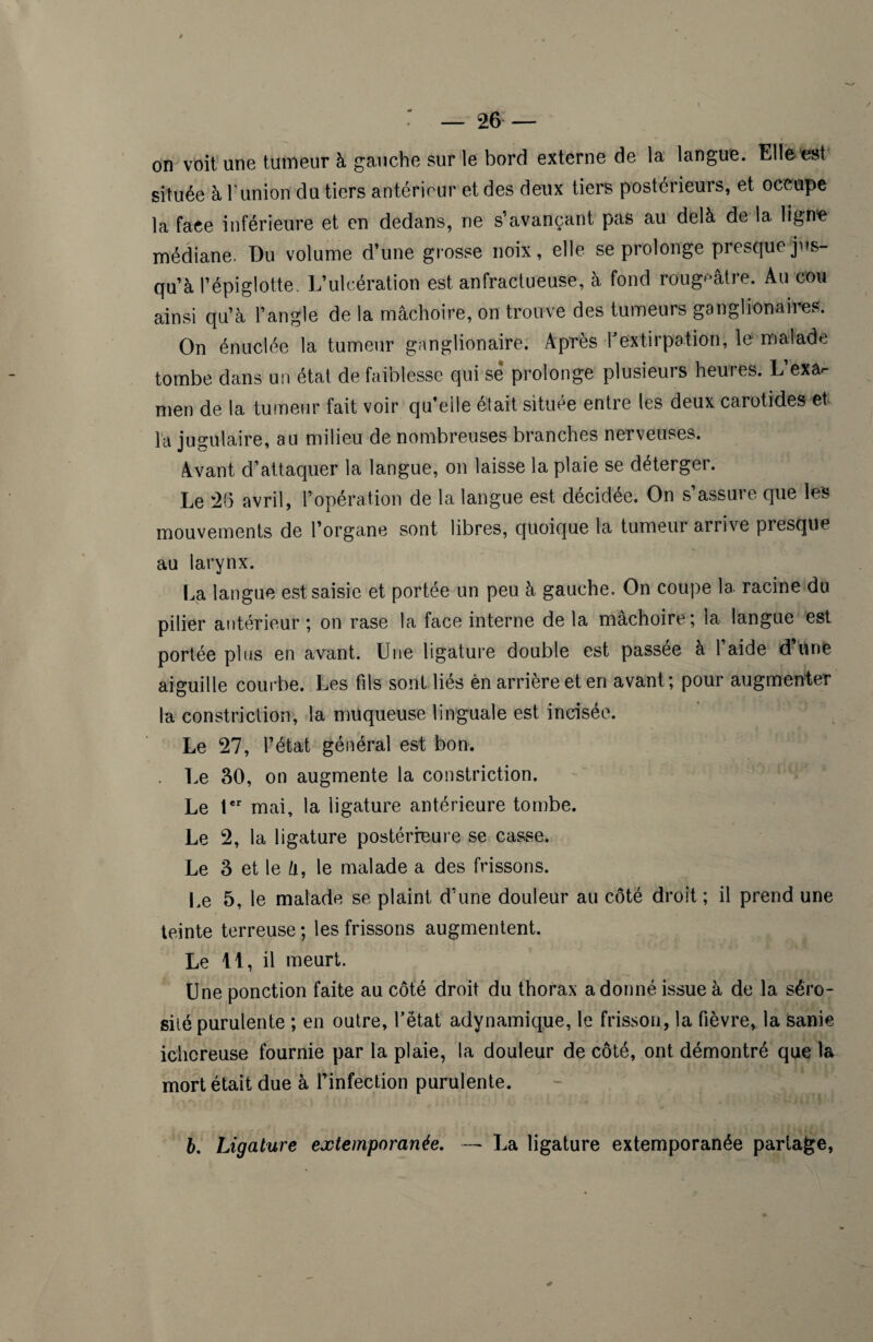 / ' — 26 — on voit une tumeur à gauche sur le bord externe de la langue. Elle**»! située à l'union du tiers antérieur et des deux tiers postérieurs, et occupe la face inférieure et en dedans, ne s’avançant pas au delà de la ligne médiane. Du volume d’une grosse noix, elle se prolonge presque jus¬ qu’à l’épiglotte. L’ulcération est anfractueuse, à fond rougeâtre. Au cou ainsi qu’à l’angle de la mâchoire, on trouve des tumeurs ganglionaires. On énuclée la tumeur ganglionaire. Après h extirpation, le malade tombe dans un état de faiblesse qui sê prolonge plusieurs heures. L’ex&- men de la tumeur fait voir qu’elle était située entre les deux carotides et la jugulaire, au milieu de nombreuses branches nerveuses. Avant d’attaquer la langue, on laisse la plaie se déterger. Le 26 avril, l’opération de la langue est décidée. On s assure que les mouvements de l’organe sont libres, quoique la tumeur arrive presque au larynx. La langue est saisie et portée un peu à gauche. On coupe la racine du pilier antérieur ; on rase la face interne de la mâchoire; la langue est portée plus en avant. Une ligature double est passée à 1 aide d une aiguille courbe. Les fils sont liés èn arrière et en avant; pour augmenter la constriclion, la muqueuse linguale est incisée. Le 27, l’état général est bon. . Le 30, on augmente la constriction. Le 1er mai, la ligature antérieure tombe. Le 2, la ligature postérieure se casse. Le 3 et le à, le malade a des frissons. Le 5, le malade se plaint d’une douleur au côté droit ; il prend une teinte terreuse ; les frissons augmentent. Le 11, il meurt. Une ponction faite au côté droit du thorax adonné issue à de la séro¬ sité purulente ; en outre, l’état adynamique, le frisson, la fièvre, la sanie iclicreuse fournie par la plaie, la douleur de côté, ont démontré que la mort était due à l’infection purulente. 6. Ligature extemporanée. — La ligature extemporanée partage,