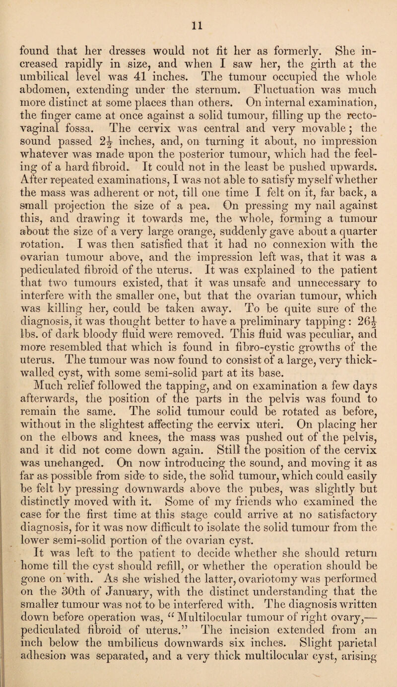 found that her dresses would not fit her as formerly. She in¬ creased rapidly in size, and when I saw her, the girth at the umbilical level was 41 inches. The tumour occupied the whole abdomen, extending under the sternum. Fluctuation was much more distinct at some places than others. On internal examination, the finger came at once against a solid tumour, filling up the recto¬ vaginal fossa. The cervix was central and very movable; the sound passed 2^ inches, and, on turning it about, no impression whatever was made upon the posterior tumour, which had the feel¬ ing of a hard fibroid.. It could not in the least be pushed upwards. After repeated examinations, I was not able to satisfy myself whether the mass was adherent or not, till one time I felt on it, far back, a small projection the size of a pea. On pressing my nail against this, and drawing it towards me, the whole, forming a tumour about the size of a very large orange, suddenly gave about a quarter rotation. I was then satisfied that it had no connexion with the ovarian tumour above, and the impression left was, that it was a pediculated fibroid of the uterus. It was explained to the patient that two tumours existed, that it was unsafe and unnecessary to interfere with the smaller one, but that the ovarian tumour, which was killing her, could be taken away. To be quite sure of the diagnosis, it was thought better to have a preliminary tapping: 26^ Ibs. of dark bloody fluid were removed. This fluid was peculiar, and more resembled that which is found in fibro-eystic growths of the uterus. The tumour was now found to consist of a large, very thick- walled cyst, with some semi-solid part at its base. Much relief followed the tapping, and on examination a few days afterwards, the position of the parts in the pelvis w^as found to remain the same. The solid tumour could be rotated as before, without in the slightest affecting the cervix uteri. On placing her on the elbows and knees, the mass was pushed out of the pelvis, and it did not come down again. Still the position of the cervix was unchanged. On now introducing the sound, and moving it as far as possible from side to side, the solid tumour, which could easily be felt by pressing downwards above the pubes, was slightly but distinctly moved with it. Some of my friends who examined the case for the first time at this stage could arrive at no satisfactory diagnosis, for it was now difficult to isolate the solid tumour from the lower semi-solid portion of the ovarian cyst. It was left to the patient to decide whether she should return home till the cyst should refill, or whether the operation should be gone on with. As she wished the latter, ovariotomy was performed on the 30th of January, with the distinct understanding that the smaller tumour was not to be interfered with. The diagnosis written down before operation was, u Multilocular tumour of right ovary,— pediculated fibroid of uterus.” The incision extended from an inch below the umbilicus downwards six inches. Slight parietal adhesion was separated, and a very thick multilocular cyst, arising