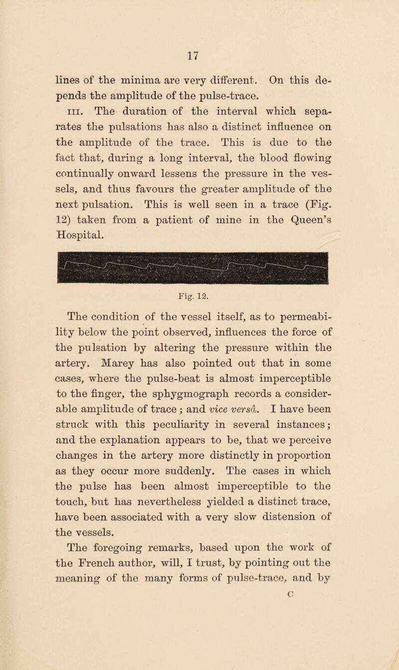 lines of the minima are very different. On this de¬ pends the amplitude of the pulse-trace. hi. The duration of the interval which sepa¬ rates the pulsations has also a distinct influence on the amplitude of the trace. This is due to the fact that, during a long interval, the blood flowing continually onward lessens the pressure in the ves¬ sels, and thus favours the greater amplitude of the next pulsation. This is well seen in a trace (Fig. 12) taken from a patient of mine in the Queen’s Hospital. Fig. 12. The condition of the vessel itself, as to permeabi¬ lity below the point observed, influences the force of the pulsation by altering the pressure within the artery. Marey has also pointed out that in some cases, where the pulse-beat is almost imperceptible to the finger, the sphygmograph records a consider¬ able amplitude of trace ; and vice versa. I have been struck with this peculiarity in several instances; and the explanation appears to be, that we perceive changes in the artery more distinctly in proportion as they occur more suddenly. The cases in which the pulse has been almost imperceptible to the touch, but has nevertheless yielded a distinct trace, have been associated with a very slow distension of the vessels. The foregoing remarks, based upon the work of the French author, will, I trust, by pointing out the meaning of the many forms of pulse-trace, and by c