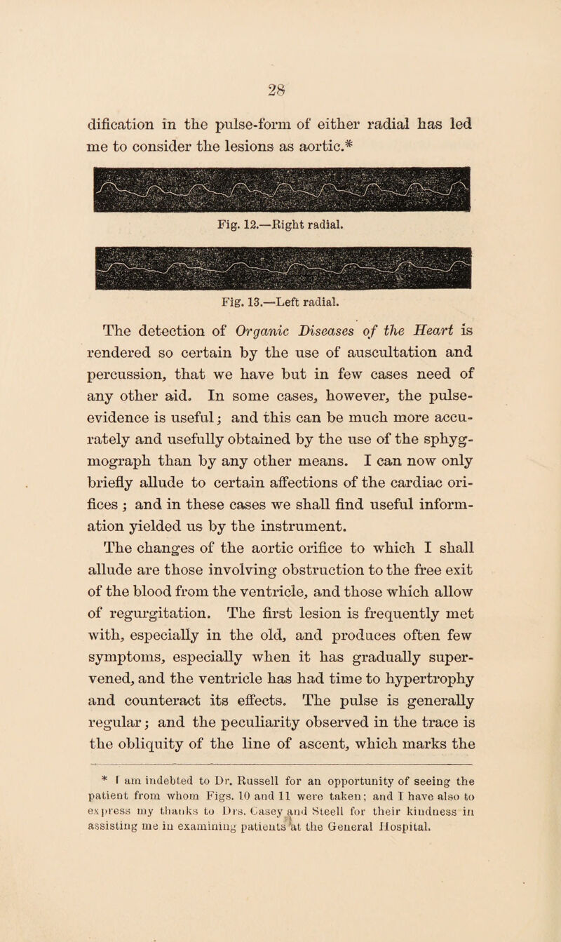 dification in tlie pulse-form of either radial has led me to consider the lesions as aortic.*' The detection of Organic Diseases of the Heart is rendered so certain by the use of auscultation and percussion, that we have but in few cases need of any other aid. In some cases, however, the pulse- evidence is useful; and this can be much more accu¬ rately and usefully obtained by the use of the sphyg- mograph than by any other means. I can now only briefly allude to certain affections of the cardiac ori¬ fices ; and in these cases we shall find useful inform¬ ation yielded us by the instrument. The changes of the aortic orifice to which I shall allude are those involving obstruction to the free exit of the blood from the ventricle, and those which allow of regurgitation. The first lesion is frequently met with, especially in the old, and prodaces often few symptoms, especially when it has gradually super¬ vened, and the ventricle has had time to hypertrophy and counteract its effects. The pulse is generally regular; and the peculiarity observed in the trace is the obliquity of the line of ascent, which marks the * r am indebted to Dr. Russell for an opportunity of seeing the patient from whom Figs. 10 and 11 were taken; and 1 have also to express my thanks to Drs. Casey and Steell for their kindness in assisting me in examining patients ’at the General Hospital.