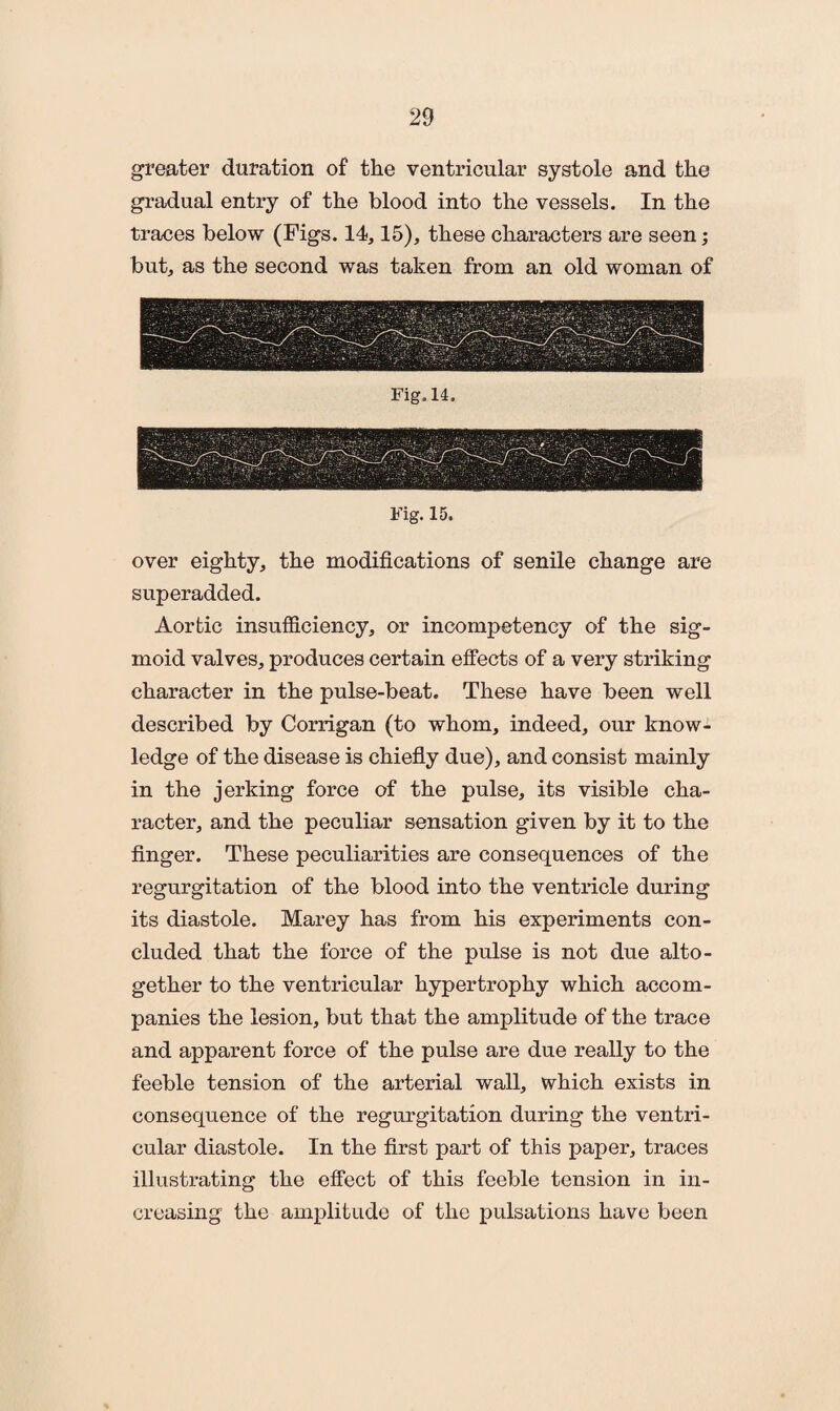 greater duration of the ventricular systole and the gradual entry of the blood into the vessels. In the traces below (Figs. 14,15), these characters are seen; but, as the second was taken from an old woman of Fig. 15. over eighty, the modifications of senile change are superadded. Aortic insufficiency, or incompetency of the sig¬ moid valves, produces certain effects of a very striking character in the pulse-beat. These have been well described by Corrigan (to whom, indeed, our know¬ ledge of the disease is chiefly due), and consist mainly in the jerking force of the pulse, its visible cha¬ racter, and the peculiar sensation given by it to the finger. These peculiarities are consequences of the regurgitation of the blood into the ventricle during its diastole. Marey has from his experiments con¬ cluded that the force of the pulse is not due alto¬ gether to the ventricular hypertrophy which accom¬ panies the lesion, but that the amplitude of the trace and apparent force of the pulse are due really to the feeble tension of the arterial wall, which exists in consequence of the regurgitation during the ventri¬ cular diastole. In the first part of this paper, traces illustrating the effect of this feeble tension in in¬ creasing the amplitude of the pulsations have been