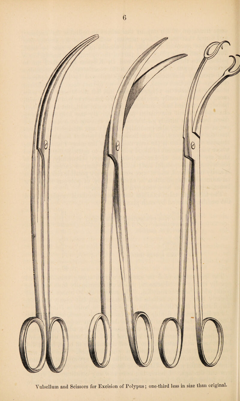 Yulsellum and Scissors for Excision of Potypus; one-third less