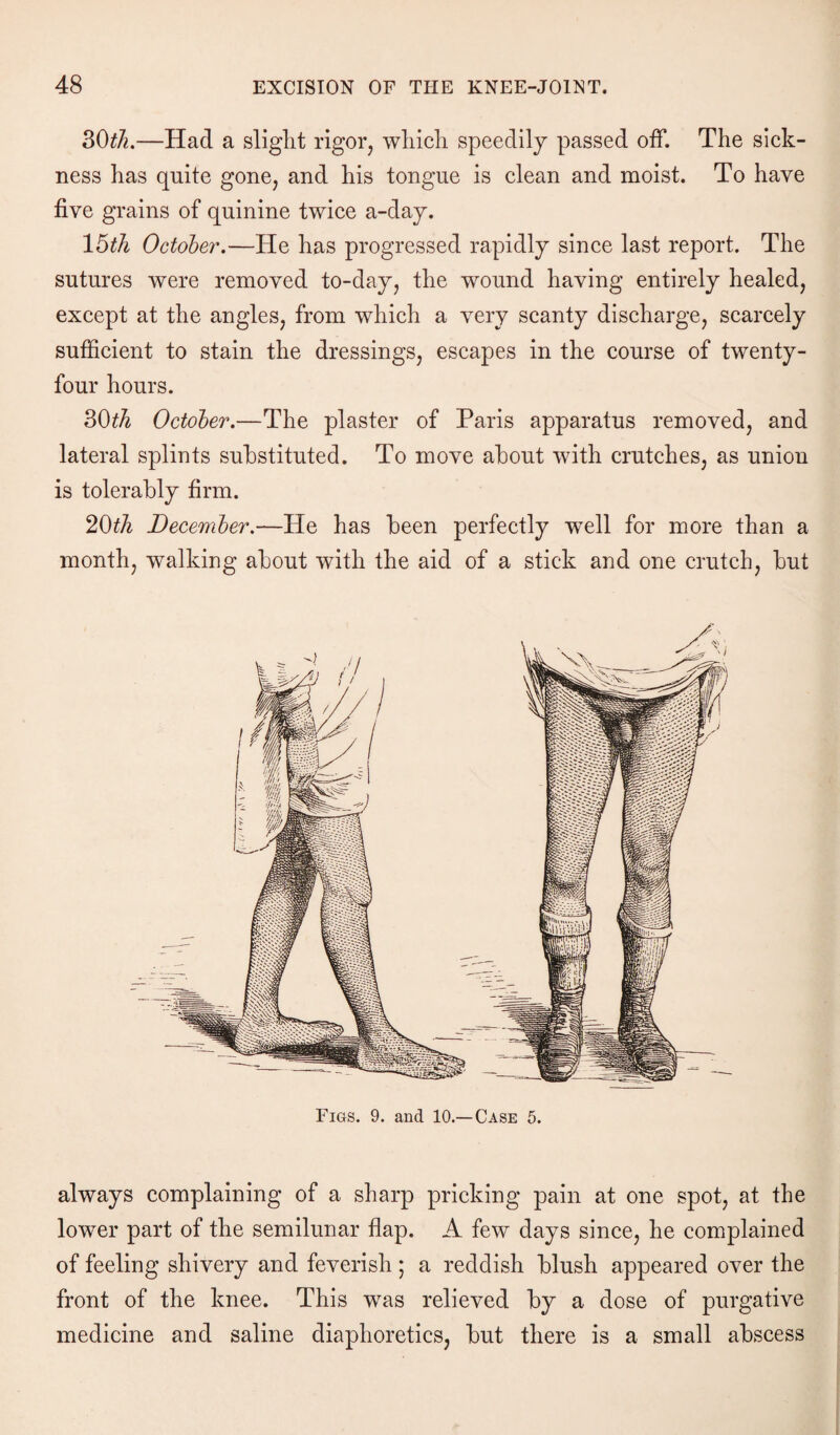 3(M.—Had a sliglit rigor, which speedily passed off. The sick¬ ness has quite gone, and his tongue is clean and moist. To have five grains of quinine twice a-day. 15th October.—He has progressed rapidly since last report. The sutures were removed to-day, the wound having entirely healed, except at the angles, from which a very scanty discharge, scarcely sufficient to stain the dressings, escapes in the course of twenty- four hours. 30th October.—The plaster of Paris apparatus removed, and lateral splints substituted. To move about with crutches, as union is tolerably firm. 20th December.—He has been perfectly wTell for more than a month, walking about with the aid of a stick and one crutch, but Figs. 9. and 10.—Case 5. always complaining of a sharp pricking pain at one spot, at the lower part of the semilunar flap. A few days since, he complained of feeling shivery and feverish; a reddish blush appeared over the front of the knee. This was relieved by a dose of purgative medicine and saline diaphoretics, but there is a small abscess