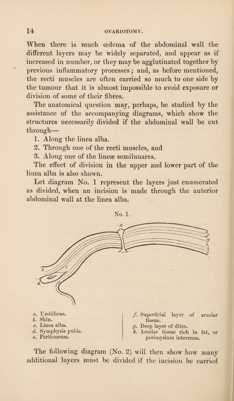 When there is much oedema of the abdominal wall the different layers may be widely separated, and appear as if increased in number, or they may be agglutinated together by previous inflammatory processes; and, as before mentioned, the recti muscles are often carried so much to one side by the tumour that it is almost impossible to avoid exposure or division of some of their fibres. The anatomical question may, perhaps, be studied by the assistance of the accompanying diagrams, which show the structures necessarily divided if the abdominal wall be cut through— 1. Along the linea alba. 2. Through one of the recti muscles, and 3. Along one of the linese semilunares. The effect of division in the upper and lower part of the linea alba is also shown. Let diagram No. 1 represent the layers just enumerated as divided, when an incision is made through the anterior abdominal wall at the linea alba. No. 1. a. Umbilicus. b. Skin. c. Linea alba. d. Symphysis pubis. e. Peritoneum. f. Superficial layer of areolar tissue. g. Deep layer of ditto. h. Areolar tissue rich in fat, or perimysium internum. The following diagram (No. 2) will then show how many additional layers must be divided if the incision be carried