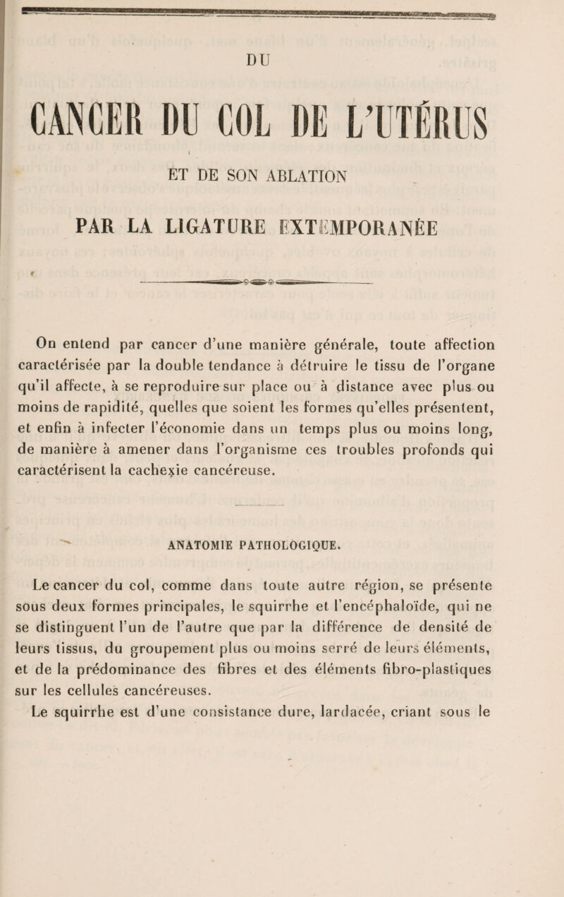 DU ET DE SON ABLATION PAR LA LIGATURE EXTEMPORANÉE -—rsnüür '? -lîisr  r~__ On entend par cancer d’une manière générale, toute affection caractérisée par la double tendance à détruire le tissu de l’organe qu’il affecte, à se reproduire sur place ou à distance avec plus ou moins de rapidité, quelles que soient les formes qu’elles présentent, et enfin à infecter l’économie dans un temps plus ou moins long, de manière à amener dans l’organisme ces troubles profonds qui caractérisent la cachexie cancéreuse. ANATOMIE PATHOLOGIQUE. Le cancer du col, comme dans toute autre région, se présente sous deux formes principales, le squirrhe et l’encéphaloïde, qui ne se distinguent l’un de l’autre que par la différence de densité de leurs tissus, du groupement plus ou moins serré de leurs éléments, et de la prédominance des fibres et des éléments fibro-piastiques sur les cellules cancéreuses. Le squirrhe est d’une consistance dure, lardacée, criant sous le