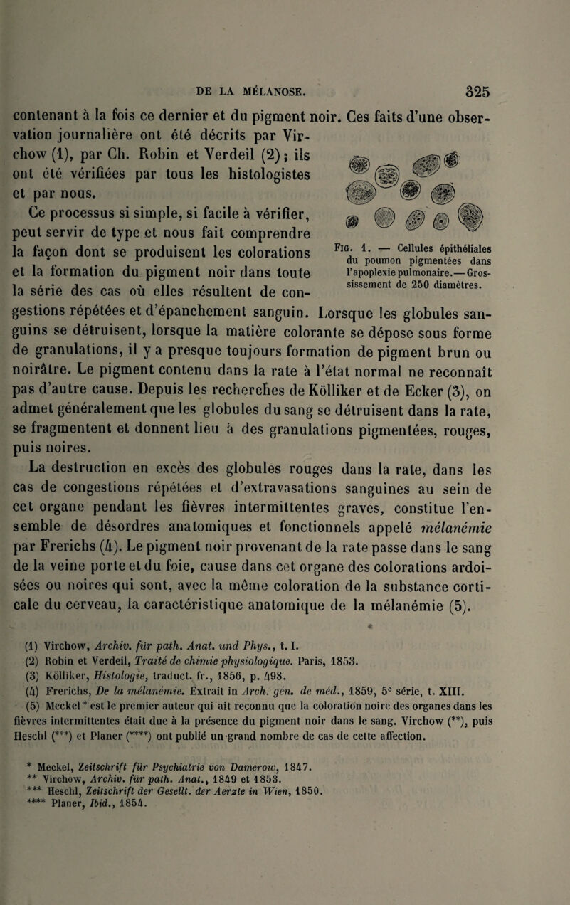 conlenant a la fois ce dernier et du pigment noir. Ces faits d’une obser¬ vation journaliere ont ete decrits par Vir¬ chow (1), par Ch. Robin et Verdeil (2); iis ont ete verifiees par tous les histologistes et par nous. Ce processus si simple, si facile k verifier, peut servir de type et nous fait comprendre la fa^on dont se produisent les colorations et la formation du pigment noir dans toute la serie des cas ou elles resultent de con¬ gestions repetees et d’epanchement sanguin. Lorsque les globules san- guins se detruisent, lorsque la matiere colorante se depose sous forme de granulations, il y a presque toujours formation de pigment brun ou noirklre. Le pigment contenu dans la rate a l’elat normal ne reconnait pas d’autre cause. Depuis les rechercfies de Kolliker et de Ecker (3), on admet generalement que les globules du sang se detruisent dans la rate, se fragmentent et donnent lieu a des granulations pigmentees, rouges, puis noires. La destruction en exces des globules rouges dans la rate, dans les cas de congestions repetees et d’extravasations sanguines au sein de cet organe pendant les fievres intermittentes graves, constitue l’en- semble de desordres anatomiques et fonctionnels appele melanemie par Frerichs (4), Le pigment noir provenant de la rate passe dans le sang de la veine porte et du foie, cause dans cet organe des colorations ardoi- sees ou noires qui sont, avec la meme coloration de la substance corti¬ cate du cerveau, la caracteristique anatomique de la melanemie (5). ^ # (1) Virchow, Archiv. fur path. Amt. und Phys., 1.1. (2) Robin et Verdeil, Traite de chimie physiologique. Paris, 1853. (3) Kolliker, Histologie, traduct. fr., 1856, p. 498. {lx) Frerichs, De la melanemie. Extrait in Arch. gen. de med., 1859, 5e serie, t. XIIL (5) Meckel * est le premier auteur qui ait reconnu que la coloration noire des organes dans les fievres intermittentes etait due a la presence du pigment noir dans le sang. Virchow (**), puis Heschl (***) et Planer (****) ontpublie un grand nombre de cas de cette affection. * Meckel, Zeitschrift fur Psychiatrie von Damerow, 1847. ** Virchow, Archiv. fur path. Anat.t 1849 et 1853. *** Heschl, Zeitschrifl der Gesellt. der Aerzte in Wien, 1850. **** pianeFj ibid., 1854. Fig. 1. — Cellules epith61iales du poumon pigmentees dans l’apoplexie pulmonaire.—Gros- sissement de 250 diametres.