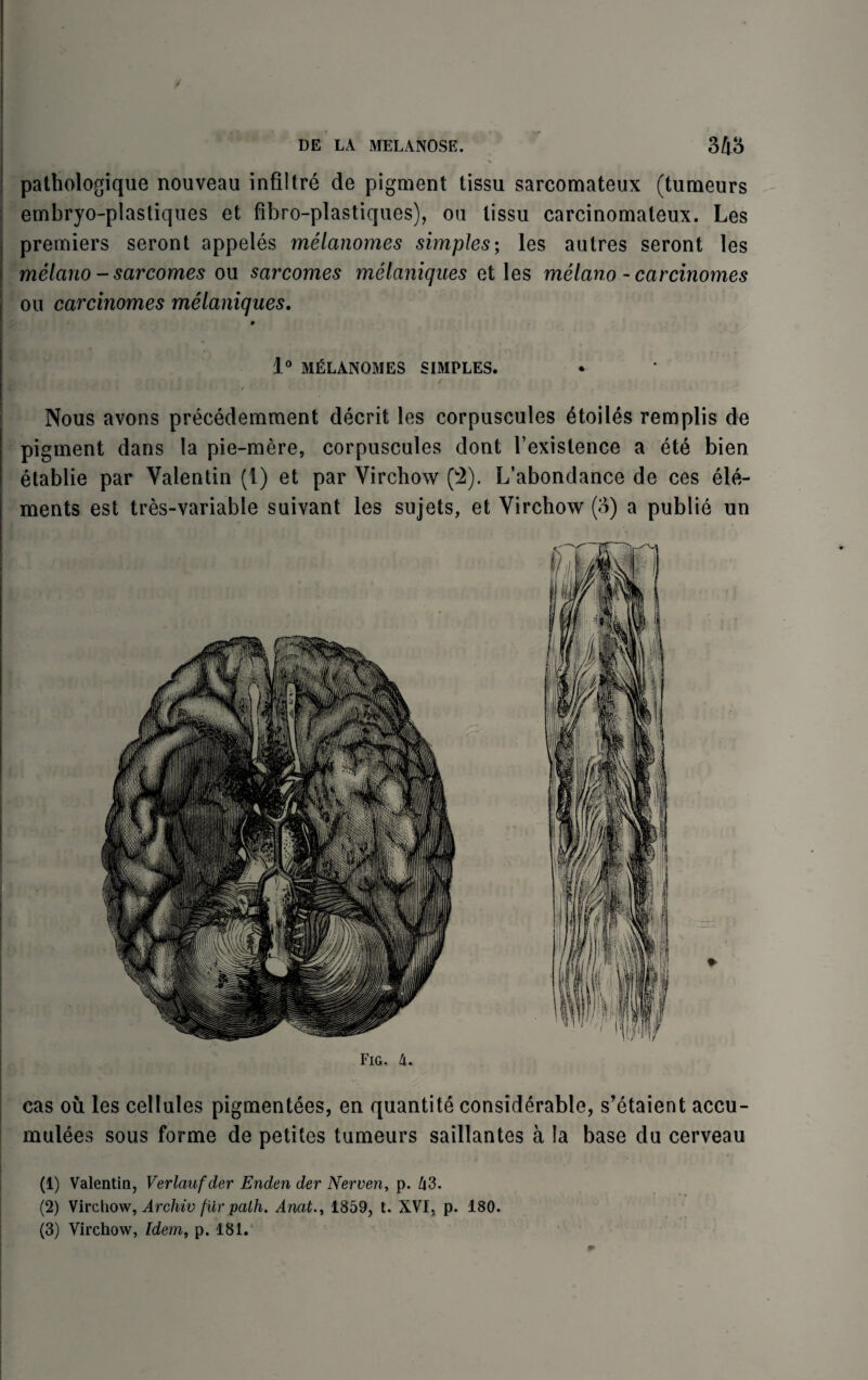 pathologique nouveau infiltre de pigment tissu sarcomateux (tumeurs embryo-plastiques et fibro-plastiques), ou lissu carcinomateux. Les premiers seront appeles melanomes simples; les autres seront les melano - sarcomes ou sarcomes melaniques et les melano - carcinomes ou carcinomes melaniques. 1° MELANOMES SIMPLES. Nous avons precedemment decrit les corpuscules etoiles remplis de pigment dans la pie-mere, corpuscules dont l’exislence a et6 bien etablie par Valentin (1) et par Virchow (2). L’abondance de ces ele¬ ments est tres-variable suivant les sujets, et Virchow (3) a publie un cas ou les cellules pigmentees, en quantite considerable, s’etaient accu- mulees sous forme de petites tumeurs saillantes a la base du cerveau (1) Valentin, Verlaufder Enden der Nerven, p. Zi3. (2) Virchow, Archiv fur path. Anat1859, t. XVI, p. 180. (3) Virchow, Idem, p. 181.