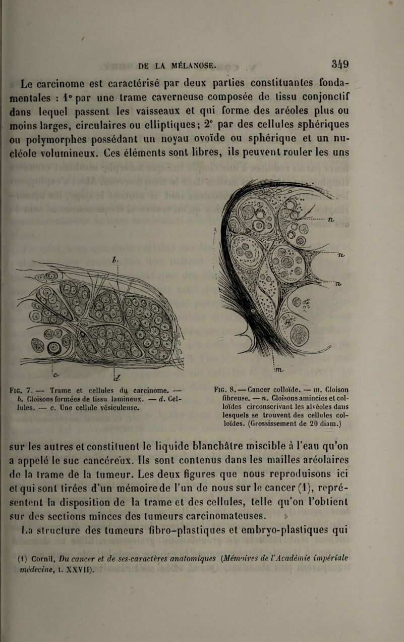 / DE LA MfiLANOSE. 349 Le carcinoma est caracterise par deux parties conslituantes fonda- mentales : 1° par une trame caverneuse composee de tissu conjonclif dans lequel passent les vaisseaux et qui forme des areoles plus ou moins larges, circulaires ou elliptiques; 2° par des cellules spheriques ou polymorphes possedant un noyau ovo'ide ou spherique et un nu- cleole volumineux. Cos elements sont libres, ils peuvent rouler les uns Ilules. — c. line cellule vesiculeuse. loides circonscrivant les alveoles dans lesquels se trouvent des cellules col- loides. (Grossissement de 20 diam.) - sur les autres et constituent Ie liquide blancMlre miscible a l’eau qu’on a appele le sue canccreux. Ils sont contenus dans les mailles areolaires de In trame de la tumeur. Les deux figures que nous reproduisons ici et qui sont lirees d’un memoirede fun de nous sur le cancer (I), ropre- sentent la disposition de la trame et des cellules, telle qu’on l’obtient sur des sections minces des lumeurs carcinomateuses. La structure des tumeurs fibro-plastiques et embryo-plasliques qui (1) Cornil, Du cancer et de ses-caracteres analomiques (Memoires de VAcademic imperiale