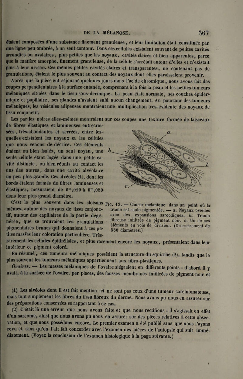 DE LA MtiLANOSE. 367 Etaient composes d’une substance finement granuleuse, et leur limitation ^tait constitute par une ligne peu ombrEe, 5 un seul contour. Dans ces cellules existaient souvent de petites cavites arrondies ou ovalaires, plus petites que les noyaux, cavites claires et bien apparentes, parce que la matiEre amorphe, finement granuleuse, de la cellule s’arretait autour d’elles et n’existait plus a leur niveau. Ces mEmes petites cavites claires et transparentes, ne contenant pas de granulations, Etaient le plus souvent au contact des noyaux dont elles paraissaient provenir. AprEs que la piEce eut sejournE quelques jours dans l’acide chromique , nous avons fait des coupes perpendiculaires a la surface culanEe, comprenant a la fois la peau et les petites tumeurs mElaniques situEes dans le tissu sous-dermique. La peau Etait normale, ses couches Epider1 2- mique et papillaire, ses glandes n’avaient subi aucun cliangement. Au pour tour des tumeurs mElaniques, les vesicules adipeuses montraient une multiplication tres-evidente des noyaux de tissu conjonctif. Les parties noires elles-memes montraient sur ces coupes une texture formEe de faisceaux de fibres elastiques et lamineuses entrecroi- sEes, tres-abondantes et senses, entre les- quelles existaient les noyaux et les cellules que nous venons de dEcrire. Ces Elements Etaient ou bien isoles, un seul noyau, une seule cellule Etant logEe dans une petite ca¬ vity distincte, ou bien rEunis au contact les uns des autres, dans une cavite alvEoIaire un peu plus grande. Ces alveoles (1), dont les bords Etaient formas de fibres lamineuses et Elastiques, mesuraient de 0m,010 h 0m,050 dans leur plus grand diametre. C’est le plus souvent dans les cloisons Fig. 13. _ Cancer m<Slanique dans un point ou la NX trame est seule pigmentee. — a. Noyaux ovoides avec des expansions sarcodiques. b. Trame fibreuse infiltree de pigment noir. c. Un de ces elements en voie de division. (Grossissemsnt de 550 diametres.) memes, autour des noyaux de tissu conjonc¬ tif, autour des capillaires de la partie degE- nEre'e, que se trouvaient les granulations pigmentaires brunes qui donnaient a ces pe¬ tites masses leur coloration particuliEre. TrEs- rarement les cellules EpithEliales, et plus rarement encore les noyaux, prEsentaient dans leur intErieur ce pigment colorE. En rEsumE , ces tumeurs mElaniques possEdent la structure du squirrhe (2), tandis que le plus souvent les tumeurs mElaniques appartiennent aux fibro-plastiques. Ovaires. — Les masses mElaniques de l’ovaire siEgeaient en differents points : d’abord il y avait, a la surface de l’ovaire, par places, des fausses membranes infiltrEes de pigment noir et (1) Les alvEoles dont il est fait mention ici ne sont pas ceux d’une tumeur carcinomateuse, mais tout simplement les fibres du tissu fibreux du derme. Nous avons pu nous en assurer sur des prEparations conservEes se rapportant a ce cas. (2) C’Etait 1^ une erreur que nous avons faite et que nous rectifions : il s’agissait en effet d’un sarcome, ainsi que nous avons pu nous en assurer sur des piEces relatives a cette obser¬ vation, et que nous possEdons encore. Le premier examen a etE publiE sans que nous l’ayons revu et sans qu’on l’ait fait concorder avec l’examen des piEces de Tautopsie qui suit immE- diatement. (Voyez la conclusion de l’examen histologique a la page suivante.) t